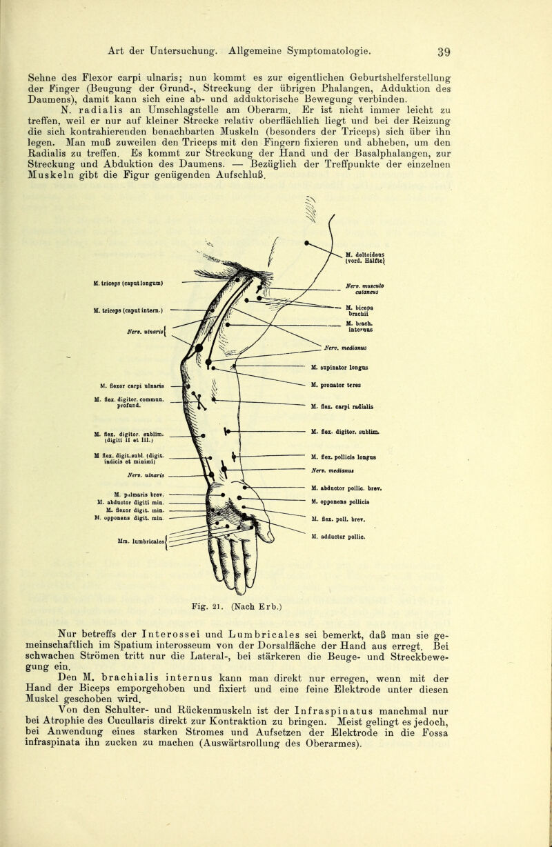 Sehne des Flexor carpi ulnaris; nun kommt es zur eigentlichen Geburtshelferstellung der Finger (Beugung der Grund-, Streckung der übrigen Phalangen, Adduktion des Daumens), damit kann sich eine ab- und adduktorische Bewegung verbinden. N. radialis an Umschlagstelle am Oberarm. Er ist nicht immer leicht zu treffen, weil er nur auf kleiner Strecke relativ oberflächlich liegt und bei der Reizung die sich kontrahierenden benachbarten Muskeln (besonders der Triceps) sich über ihn legen. Man muß zuweilen den Triceps mit den Fingern fixieren und abheben, um den Radialis zu treffen. Es kommt zur Streckung der Hand und der Basalphalangen, zur Streckung und Abduktion des Daumens. — Bezüglich der Treffpunkte der einzelnen Muskeln gibt die Figur genügenden Aufschluß. M. triceps (caputloogum) M. triceps (caput intern ) Nero, ulnarit^ M. flexor carpi ulnaris M. Sex. digitor. common, profund. II. flex. digitor. sublim, (digiti Ii et III.) M flex. digit.subl. (digit. iudicis et miniral) Nerv, ulnarit M. pulmaris brev. M. abductor digiti min. M. flexor digit. min. M. opponens digit. min. Mm. lumbricales M. flex. digitor. sublim. M. flex. pollicis longus Nerv, mtdianut M. abductor poilic. brev. M. opponens pollicis M. flex. poll. brev. M. adductor poilic. Fig. 21. (Nach Erb.) Nur betreffs der Interossei und Lumbricales sei bemerkt, daß man sie ge- meinschaftlich im Spatium interosseum von der Dorsalfläche der Hand aus erregt. Bei schwachen Strömen tritt nur die Lateral-, bei stärkeren die Beuge- und Streckbewe- gung ein. Den M. brachialis internus kann man direkt nur erregen, wenn mit der Hand der Biceps emporgehoben und fixiert und eine feine Elektrode unter diesen Muskel geschoben wird. Von den Schulter- und Rückenmuskeln ist der Infraspinatus manchmal nur bei Atrophie des Cucullaris direkt zur Kontraktion zu bringen. Meist gelingt es jedoch, bei Anwendung eines starken Stromes und Aufsetzen der Elektrode in die Fossa infraspinata ihn zucken zu machen (Auswärtsrollung des Oberarmes).