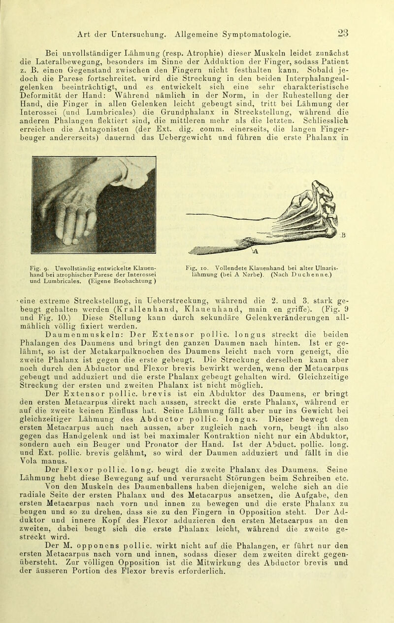 Bei unvollständiger Lähmung (resp. Atrophie) dieser Muskeln leidet zunächst die Lateralbewegung, besonders im Sinne der Adduktion der Finger, sodass Patient z. B. einen Gegenstand zwischen den Fingern nicht festhalten kann. Sobald je- doch die Parese fortschreitet, wird die Streckung in den beiden Interphalangeal- gelenken beeinträchtigt, und es entwickelt sich eine sehr charakteristische Deformität der Hand: Während nämlich in der Norm, in der Ruhestellung der Hand, die Finger in allen Gelenken leicht gebeugt sind, tritt bei Lähmung der Interossei (und Lumbricales) die Grundphalanx in Strecksteilung, während die anderen Phalangen flektiert sind, die mittleren mehr als die letzten. Schliesslich erreichen die Antagonisten (der Ext. dig. comm. einerseits, die langen Finger- beuger andererseits) dauernd das Uebergewicht und führen die erste Phalanx in Fig. 9. Unvollständig entwickelte Klauen- hand bei atrophischer Parese der Interossei und Lumbricales. (Eigene Beobachtung ) Fig, IO. Vollendete Klauenhand bei alter Ulnaris- lähmung (bei A Narbe). (Nach Duchenne.) •eine extreme Streckstellung, in Ueberstreckung, während die 2. und 3. stark ge- beugt gehalten werden (Krallenhand, Klauenhand, main en griffe). (Fig. 9 und Fig. 10.) Diese Stellung kann durch sekundäre Gelenkveränderungen all- mählich völlig fixiert werden. Daumenmuskeln: Der Extensor pollic. longus streckt die beiden Phalangen des Daumens und bringt den ganzen Daumen nach hinten. Ist er ge- lähmt, so ist der Metakarpalknochen des Daumens leicht nach vorn geneigt, die zweite Phalanx ist gegen die erste gebeugt. Die Streckung derselben kann aber noch durch den Abductor und Flexor brevis bewirkt werden, wenn der Metacarpus gebeugt und adduziert und die erste Phalanx gebeugt gehalten wird. Gleichzeitige Streckung der ersten und zweiten Phalanx ist nicht möglich. Der Extensor pollic. brevis ist ein Abduktor des Daumens, er bringt den ersten Metacarpus direkt nach aussen, streckt die erste Phalanx, während er auf die zweite keinen Einfluss hat. Seine Lähmung fällt aber nur ins Gewicht bei gleichzeitiger Lähmung des Abductor pollic. longus. Dieser bewegt den ersten Metacarpus auch nach aussen, aber zugleich nach vorn, beugt ihn also gegen das Handgelenk und ist bei maximaler Kontraktion nicht nur ein Abduktor, sondern auch ein Beuger und Pronator der Pland. Ist der Abduct. pollic. long. und Ext. pollic. brevis gelähmt, so wird der Daumen adduziert und fällt in die Vola manus. Der Flexor pollic. long. beugt die zweite Phalanx des Daumens. Seine Lähmung hebt diese Bewegung auf und verursacht Störungen beim Schreiben etc. Von den Muskeln des Daumenballens haben diejenigen, welche sich an die radiale Seite der ersten Phalanx und des Metacarpus ansetzen, die Aufgabe, den ersten Metacarpus nach vorn und innen zu bewegen und die erste Phalanx zu beugen und so zu drehen, dass sie zu den Fingern in Opposition steht. Der Ad- duktor und innere Kopf des Flexor adduzieren den ersten Metacarpus an den zweiten, dabei beugt sich die erste Phalanx leicht, während die zweite ge- streckt wird. Der M. opponens pollic. wirkt nicht auf die Phalangen, er führt nur den ersten Metacarpus nach vorn und innen, sodass dieser dem zweiten direkt gegen- übersteht. Zur völligen Opposition ist die Mitwirkung des Abductor brevis und der äusseren Portion des Flexor brevis erforderlich.