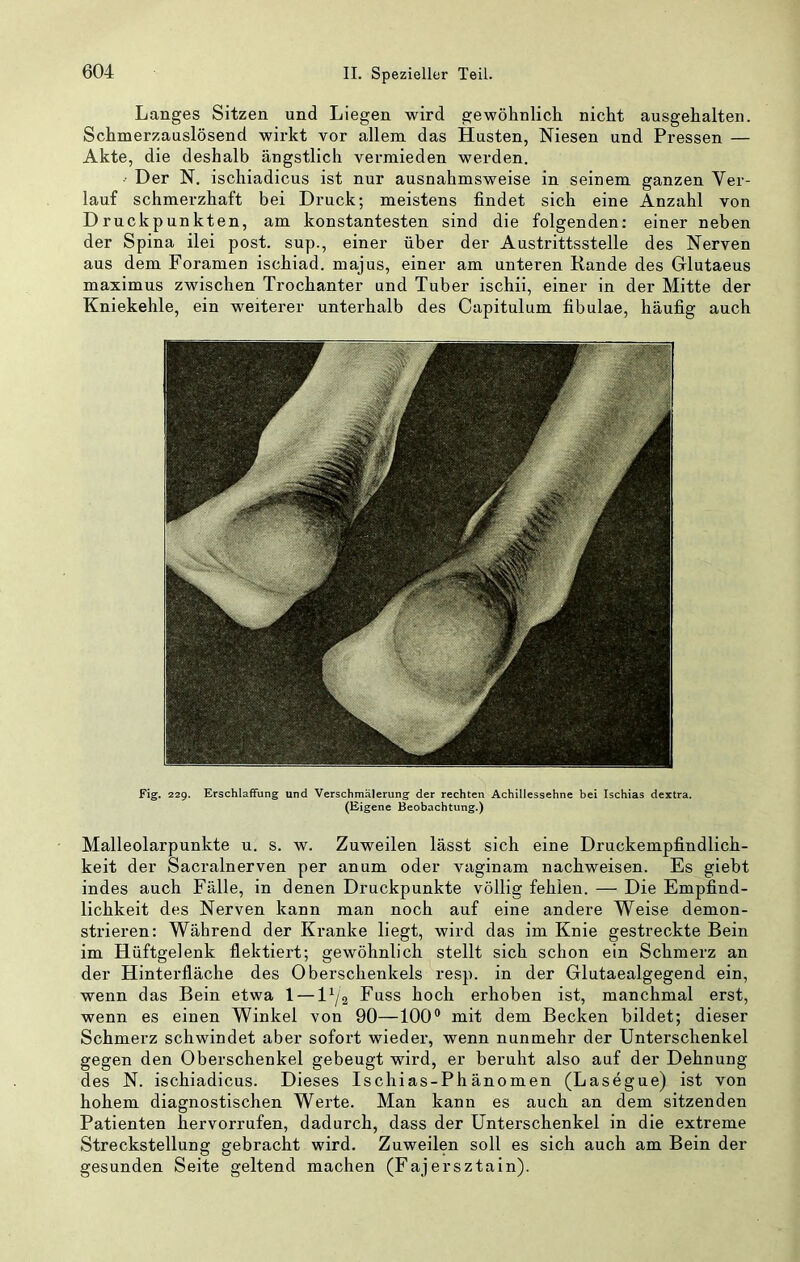 Langes Sitzen und Liegen wird gewöhnlich nicht ausgehalteii. Schmerzauslösend wirkt vor allem das Husten, Niesen und Pressen — Akte, die deshalb ängstlich vermieden werden. ■ Der N. ischiadicus ist nur ausnahmsweise in seinem ganzen Ver- lauf schmerzhaft bei Druck; meistens findet sich eine Anzahl von Druckpunkten, am konstantesten sind die folgenden: einer neben der Spina ilei post, sup., einer über der Austrittsstelle des Nerven aus dem Foramen ischiad. majus, einer am unteren Kande des Grlutaeus maximus zwischen Trochanter und Tuber ischii, einer in der Mitte der Kniekehle, ein weiterer unterhalb des Capitulum fibulae, häufig auch Fig. 229. Erschlaffung und Verschmälerung der rechten Achillessehne bei Ischias dextra. (Eigene Beobachtung.) Malleolarpunkte u. s. w. Zuweilen lässt sich eine Druckempfindlich- keit der Sacralnerven per anum oder vaginam nachweisen. Es giebt indes auch Fälle, in denen Druckpunkte völlig fehlen. — Die Empfind- lichkeit des Nerven kann man noch auf eine andere Weise demon- strieren: Während der Kranke liegt, wird das im Knie gestreckte Bein im Hüftgelenk flektiert; gewöhnlich stellt sich schon ein Schmerz an der Hinterfläche des Oberschenkels resp. in der Glutaealgegend ein, wenn das Bein etwa 1 —1^/2 Fuss hoch erhoben ist, manchmal erst, wenn es einen Winkel von 90—100® mit dem Becken bildet; dieser Schmerz schwindet aber sofort wieder, wenn nunmehr der Unterschenkel gegen den Oberschenkel gebeugt wird, er beruht also auf der Dehnung des N. ischiadicus. Dieses Ischias-Phänomen (Lasegue) ist von hohem diagnostischen Werte. Man kann es auch an dem sitzenden Patienten hervorrufen, dadurch, dass der Unterschenkel in die extreme Streckstellung gebracht wird. Zuweilen soll es sich auch am Bein der gesunden Seite geltend machen (Fajersztain).