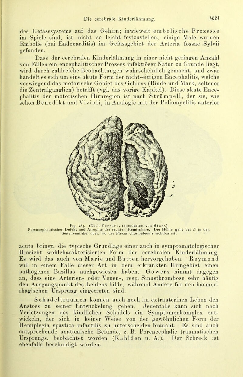 des Gefässsystems auf das Gehirn; inwieweit embolisclie Prozesse im Spiele sind, ist nicht so leicht festzustellen, einige Male wurden Embolie (bei Endocarditis) im Gefässgebiet der Arteria fossae Sylvii gefunden. Dass der cerebralen Kinderlähmung in einer nicht geringen Anzahl von Fällen ein encephalitischer Prozess infektiöser Natur zu Grunde liegt, wird durch zahlreiche Beobachtungen wahrscheinlich gemacht, und zwar handelt es sich um eine akute Form der nicht-eitrigen Encephalitis, welche vorwiegend das motorische Gebiet des Gehirns (Rinde und Mark, seltener die Zentralganglien) betrifft (vgl. das vorige Kapitel). Diese akute Ence- phalitis der motorischen Hirnregion ist nach Strümpell, der sie, wie schon Benedikt und Vizioli, in Analogie mit der Poliomyelitis anterior Fig. 2S3, (Nach Ferraro, reproduziert von Starr.) Porcncephalitischer Defekt und Atrophie der rechten Hemisphäre. Die Höhle geht bei D in den Seitenvenlrikel über, wo der Plexus chorioideus e sichtbar ist. acuta bringt, die typische Grundlage einer auch in symptomatologischer Hinsicht wohlcharakterisierten Foi-m der cerebralen Kinderlähmung. Es wird das auch von Marie und Batten hervorgehoben. Reymond will in einem Falle dieser Art in dem erkrankten Hirngebiet einen pathogenen Bazillus nachgewiesen haben. Go wers nimmt dagegen an, dass eine Arterien- oder Venen-, resp. Sinusthrombose sehr häufig den Ausgangspunkt des Leidens bilde, während Andere für den haemor- rhagischen Ursprung eingetreten sind. Schädeltraumen können auch noch ini extrauterinen Leben den Anstoss zu seiner Entwickelung geben. Jedenfalls kann sich nach Verletzungen des kindlichen Schädels ein Symptomenkomplex ent- wickeln, der sich in keiner Weise von der gewöhnlichen Form der Hemiplegia spastica infantilis zu unterscheiden braucht. Es sind auch entsprechende anatomische Befunde, z. B. Porencephalie traumatischen Ursprungs, beobachtet worden (Kah Iden u. A.). Der Schreck ist ebenfalls bescliuldigt worden.