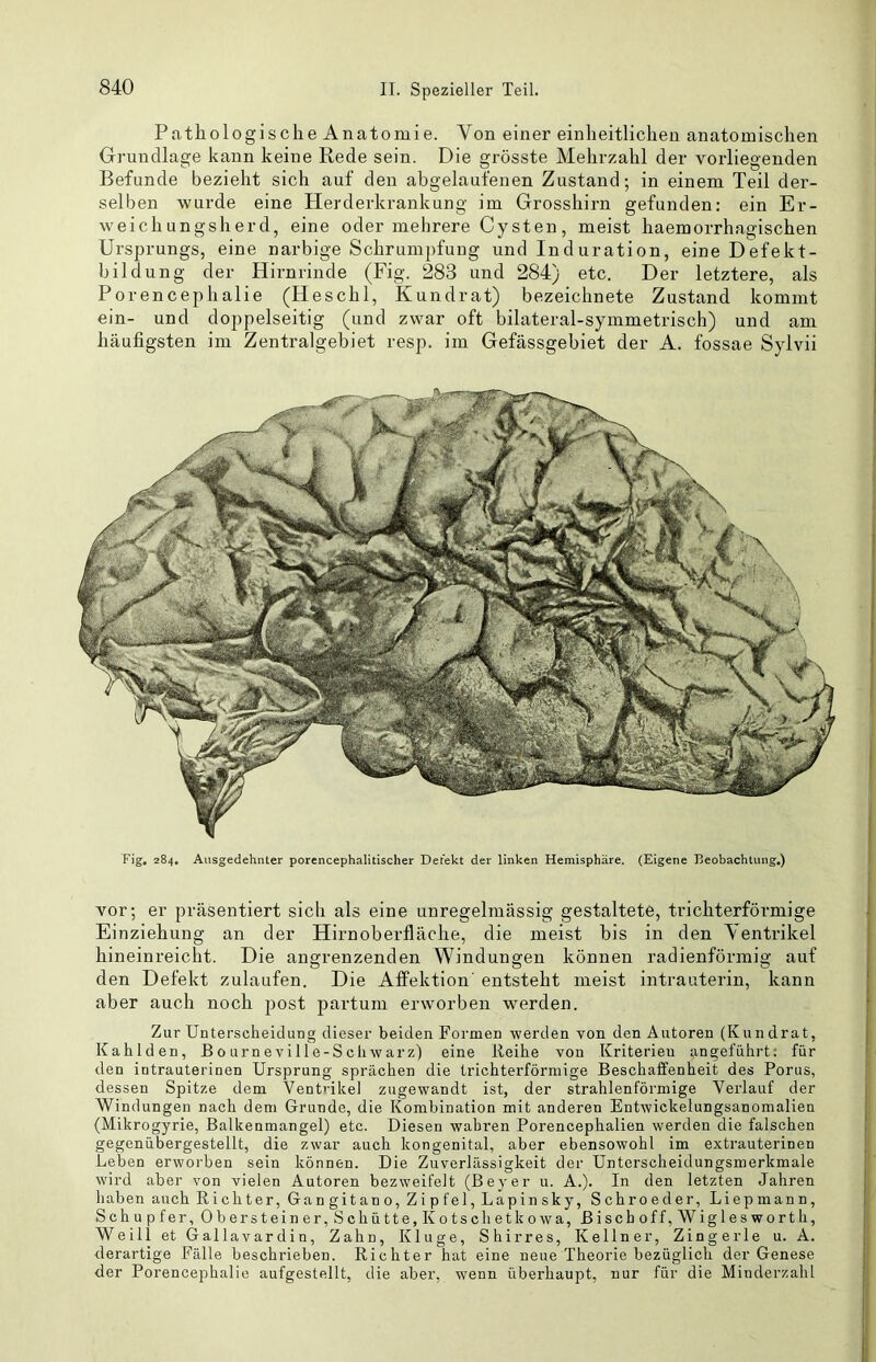 Pfithologi sehe Anatomie. Von einer einheitlichen anatomischen Grundlage kann keine Rede sein. Die grösste Mehrzahl der vorliegenden Befunde bezieht sich auf den abgelaufenen Zustand; in einem Teil der- selben wurde eine Herderkrankung im Grosshirn gefunden: ein Er- weichungsherd, eine oder mehrere Cysten, meist haemorrhagischen Ursprungs, eine narbige Schrumpfung und Induration, eine Defekt- bildung der Hirnrinde (Fig. 283 und 284) etc. Der letztere, als Porencephalie (Heschl, Kundrat) bezeichnete Zustand kommt ein- und doppelseitig (und zwar oft bilateral-symmetrisch) und am häufigsten im Zentralgebiet resp. im Gefässgebiet der A. fossae Sylvii Fig, 284. Ausgedehnter porencephalitischer Defekt der linken Hemisphäre. (Eigene Beobachtung,) vor; er präsentiert sich als eine unregelmässig gestaltete, trichterförmige Einziehung an der Hirnoberfläche, die meist bis in den Ventrikel hineinreicht. Die angrenzenden Windungen können radienförmig auf den Defekt zulaufen. Die Affektion entsteht meist intrauterin, kann aber auch noch post partum erworben w^erden. Zur Unterscheidung dieser beiden Formen werden von den Autoren (Kundrat, Kahlden, B 0 urn e vi 11 e-S cli w ar z) eine Reihe von Kriterien angeführt; für den intrauterinen Ursprung sprächen die trichterförmige Beschaffenheit des Porus, dessen Spitze dem Ventrikel zugewandt ist, der strahlenförmige Verlauf der Windungen nach dem Grunde, die Kombination mit anderen Entwickelungsanomalien (Mikrogyrie, Balkenmangel) etc. Diesen wahren Porencephalien werden die falschen gegenübergestellt, die zwar auch kongenital, aber ebensowohl im extrauterinen Leben erworben sein können. Die Zuverlässigkeit der Unterscheidungsmerkmale wird aber von vielen Autoren bezweifelt (Beyer u. A.). In den letzten Jahren haben auch Richter, Gangitano, Zipfel, Lapin sky, Schroeder, Liepmann, Schupfer, Obersteiner, Schütte, Kotschetkowa, Bischoff,Wiglesworth, Weil! et Gallavardin, Zahn, Kluge, Shirres, Kellner, Zingerle u. A. derartige Fälle beschrieben. Richter hat eine neue Theorie bezüglich der Genese der Porencephalie aufgestellt, die aber, wenn überhaupt, nur für die Minderzahl