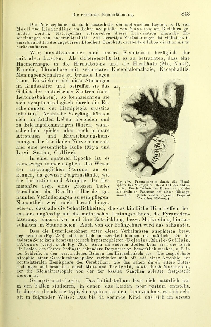 Die Porencephalie ist auch ausserhalb der motorischen Region, z. B. von Moeli und Richardiere am Lobus occipitalis, von Monakow am Kleinhirn ge- funden worden. * Naturgemäss entsprechen dieser Lokalisation klinische Er- scheinungen von anderer Qualität. Auf dei'artige Veränderungen ist vielleicht in einzelnen Fällen die angeborene Blindheit, Taubheit, cerebellare Inkoordination u.s.w. zurückzuführen. Weit unvollkommener sind unsere Kenntnisse bezüglich der initialen Läsion. Als sichergestellt ist es zu betrachten, dass eine Haemorrhagie in die Hirnsubstanz und die Hirnhäute (Mc. Nutt), Embolie, Thrombose mit sekundärer Encephalomalazie, Encephalitis, Meningoencephalitis zu Grunde liegen kann. Entwickeln sich diese. Störungen im Kindesalter und betreffen sie das /o,, Gebiet der motorischen Zentren (oder Leitungsbahnen), so kennzeichnen sie sich symptomatologisch durch die Er- scheinungen der Hemiplegia spastica infantilis. Aehnliche Vorgänge können sich im fötalen Leben abspielen und zu Bildungshemmungen führen, wahr- scheinlich spielen aber auch primäre Atrophien und Entwickelungshem- mungen der kortikalen Nervenelemente hier eine wesentliche Rolle (Mya und Levi, Sachs, Collier). In einer späteren Epoche ist es keineswegs immer möglich, das Wesen der ursprünglichen Störung zu er- kennen, da gewisse Folgezustände, wie die Induration und Atrophie der He- misphäre resp. eines grossen Teiles derselben, das Resultat aller der ge- nannten Veränderungen zu sein pflegen. Namentlich wird noch darauf hinge- wiesen, dass alle die Schädlichkeiten, die das kindliche Hirn treffen, be- sonders ungünstig auf die motorischen Leitungsbahnen, die Pyramiden- faserung, einzuwirken und ihre Entwicklung bezw. Markreifung hintan- zuhalten im Stande seien. Auch von der Frühgeburt wird das behauptet. Fig. 287, Frontalschnitt durch die Hemi Sphäre bei Mikrogyrie. Bei a Ort der Mikro- gyrie. Beschaffenheit des Hirnmarks und der subkortikalen Faserung bei dieser ßildungs- anomalie. (Nach einem eigenen Präparat Falscher Färbung) Dass die Pyramiden bahnen unter diesen Verhältnissen atrophieren bezw. degenerieren (Fig. 285) oder einfach unentwickelt bleiben, ist natürlich. Die der anderen Seite kann kompensatorisch hypertrophieren (Dejerine, Marie-Guillain, d’Abundo (vergl. auch Fig. 285). Auch an anderen Stellen kann sich die durch die Läsion des Cortex bedingte sekundäre Degeneration bemerklich machen, z. B. in der Schleife, in den verschiedenen Bahnen des Hirnschenkels etc. Die ausgedehnte Atrophie einer Grosshirnhemisphäre verbindet sich oft mit einer Atrophie der kontralateralen Hemisphäre des Cerebellum, wie das schon durch ältere Unter- suchungen und besonders durch Mott und Tredgold, sowie durch Marinesco, der die Kleinhirnatrophie von der de)' basalen Ganglien ableitet, festgestellt worden ist. Symptomatologie. Das Initialstadium lässt sich natürlich nur in den Fällen studieren, in denen das Leiden post partum entsteht. In diesen, die als die typischen gelten können, kennzeichnet es sich sehr oft in folgender Weise: Das bis da gesunde Kind, das sich im ersten