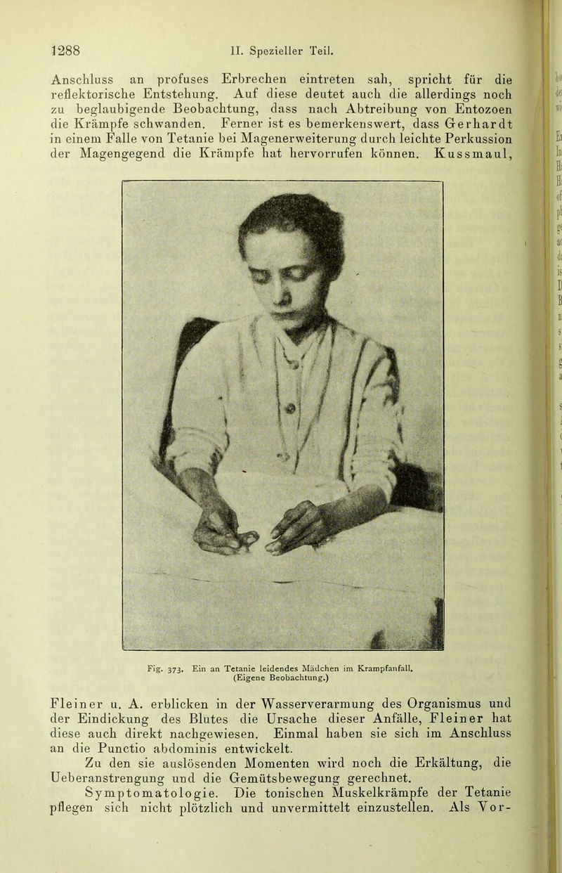 Anschluss an profuses Erbrechen eintreten sah, spricht für die reflektorische Entstehung. Auf diese deutet auch die allerdings noch zu beglaubigende Beobachtung, dass nach Abtreibung von Entozoen die Krämpfe schwanden. Ferner ist es bemerkenswert, dass Gerhardt in einem Falle von Tetanie bei Magenerweiterung durch leichte Perkussion der Magengegend die Krämpfe hat hervorrufen können. Kuss maul, 373» Ein an Tetanie leidendes Mädchen im Krampfanfall, (Eigene Beobachtung.) Flein er u. A. erblicken in der Wasserverarmung des Organismus und der Eindickung des Blutes die Ursache dieser Anfälle, Flein er hat diese auch direkt nachgewiesen. Einmal haben sie sich im Anschluss an die Punctio abdominis entwickelt. Zu den sie auslösenden Momenten wird noch die Erkältung, die Ueberanstrengung und die Gemütsbewegung gerechnet. Symptomatologie. Die tonischen Muskelkrämpfe der Tetanie pflegen sich nicht plötzlich und unvermittelt einzustellen. Als Yor-