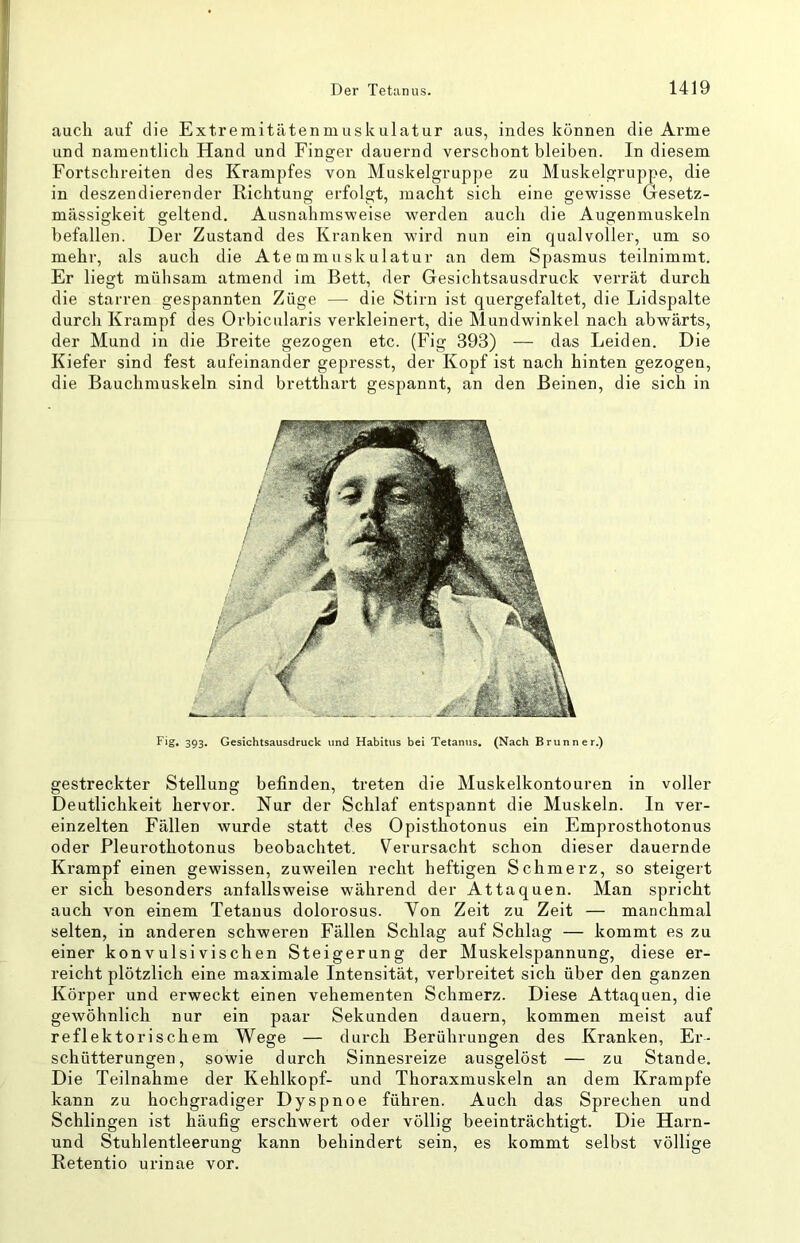 auch auf die Extremitätenmuskulatur aus, indes können die Arme und namentlich Hand und Finger dauernd verschont bleiben. In diesem Fortschreiten des Krampfes von Muskelgruppe zu Muskelgruppe, die in deszendierender Richtung erfolgt, macht sich eine gewisse Gesetz- mässigkeit geltend. Ausnahmsweise werden auch die Augenmuskeln befallen. Der Zustand des Kranken wird nun ein qualvoller, um so mehr, als auch die Ate m m usk ulatur an dem Spasmus teilnimmt. Er liegt mühsam atmend im Bett, der Gesichtsausdruck verrät durch die starren gespannten Züge — die Stirn ist quergefaltet, die Lidspalte durch Krampf des Orbicularis verkleinert, die Mundwinkel nach abwärts, der Mund in die Breite gezogen etc. (Fig 393) — das Leiden. Die Kiefer sind fest aufeinander gepresst, der Kopf ist nach hinten gezogen, die Bauchmuskeln sind bretthart gespannt, an den Beinen, die sich in gestreckter Stellung befinden, treten die Muskelkontouren in voller Deutlichkeit hervor. Nur der Schlaf entspannt die Muskeln. In ver- einzelten Fällen wurde statt des Opisthotonus ein Emprosthotonus oder Pleurothotonus beobachtet. Verursacht schon dieser dauernde Krampf einen gewissen, zuweilen recht heftigen Schmerz, so steigert er sich besonders anfallsweise während der Attaquen. Man spricht auch von einem Tetanus dolorosus. Yon Zeit zu Zeit — manchmal selten, in anderen schweren Fällen Schlag auf Schlag — kommt es zu einer konvulsivischen Steigerung der Muskelspannung, diese er- reicht plötzlich eine maximale Intensität, verbreitet sich über den ganzen Körper und erweckt einen vehementen Schmerz. Diese Attaquen, die gewöhnlich nur ein paar Sekunden dauern, kommen meist auf reflektorischem Wege — durch Berührungen des Kranken, Er- schütterungen, sowie durch Sinnesreize ausgelöst — zu Stande. Die Teilnahme der Kehlkopf- und Thoraxmuskeln an dem Krampfe kann zu hochgradiger Dyspnoe führen. Auch das Sprechen und Schlingen ist häufig erschwert oder völlig beeinträchtigt. Die Harn- und Stuhlentleerung kann behindert sein, es kommt selbst völlige Retentio urinae vor.