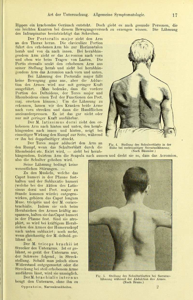 Fig. 4. Stellung des Schulterblatts in der Ruhe bei rechtsseitiger Serratuslähmung. (Nach Bäumler.) ßippen ein krachendes Geräusch entsteht. Doch giebt es auch gesunde Personen, die ein leichtes Knarren bei diesem Bewegungsversuch zu erzeugen wissen. Die Lähmung des Infraspinatus beeinträchtigt das Schreiben. Der Pectoralis major zieht den Arm an den Thorax heran. Die claviculäre Portion führt deu erhobenen Arm bis zur Horizontalen herab und von da nach innen. Bei herabhän- gendem Arm zieht er das Acromion nach vorn und oben wie beim Tragen- von Lasten. Die Portio sternalis senkt den erhobenen Arm aus seiner Stellung herab und zieht bei herabhän- gendem Arm das Acromion nach vorn und unten. Bei Lähmung des Pectoralis major fällt keine Bewegung ganz aus, aber die Adduc- tion des Armes wird nur mit geringer Kraft ausgeführt. (Man bedenke, dass die vordere Portion des Deltoideus, der Teres major und Rhomboideus einen Teil der Functionen des Pect, maj. ersetzen können.) Um die Lähmung zu erkennen, lassen wir den Kranken beide Arme nach vorn strecken und dann die Handflächen aneinanderpressen. Es ist das gar nicht oder nur mit geringer Kraft ausführbar. Der M. latissimus dorsi zieht den er- hobenen Arm nach hinten und unten, deu herab- hängenden nach innen und hinten, neigt bei einseitiger Wirkung den Rumpf zur Seite, während er ihn bei doppelseitiger streckt. Der Teres major adducirt den Arm an den Rumpf, wenn das Schulterblatt durch die Rhomboidei etc. fixirt wird, — zieht bei herab- hängendem, fixirtem Arm die Scapula nach aussen und dreht sie so, dass das Acromion, also die Schulter gehoben wird. Seine Lähmung bedingt keine wesentlichen Störungen. —• Zu den Muskeln, welche das Caput humeri in der Pfanne fest- halten und der Subluxatio humeri (welche bei der Aktion des Latis- simus dorsi und Pect, major zu Stande kommen würde) entgegen- wirken, gehören das Caput longum Muse, tricipitis und der M. coraco- brachialis. Indem sie sich beim Herabziehen des Armes kräftig an- spannen, halten sie das Caput humeri in der Pfanne fest. Sind sie atro- phirt, so wird bei kräftigem Herab- ziehen des Armes der Humeruskopf nach unten subluxirt; noch mehr, wenn gleichzeitig der M. deltoid. ge- lähmt ist. Der M. triceps brachii ist Strecker des Unterarms. Ist er ge- lähmt, so gerät der Unterarm nur, der Schwere folgend, in Streck- stellung. Sobald man jedoch einen Widerstand entgegensetzt oder die Streckung bei steil erhobenem Arme ausführen lässt wird sie unmöglich. DerM hi-a e li i a 1 i « i n t pt n n q Fis. 5. Stellung des Schulterblattes bei Serratus- jjei m. Dl a C mail S Intel n US lähmung während der Abduktion des Armes, beugt den Unterarm, ohne din zu (Nach Bruns.) Oppenheim, Nervenkrankheiten.