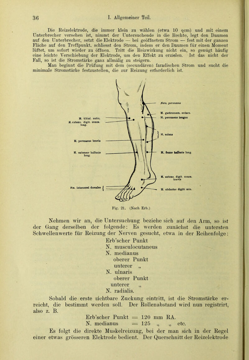 Die Reizelektrode, die immer klein zu wählen (etwa 10 qcm) und mit einem Unterbrecher versehen ist, nimmt der Untersuchende in die Rechte, legt den Daumen auf den Unterbrecher, setzt die Elektrode — bei geöffnetem Strom — fest mit der ganzen Fläche auf den Treffpunkt, schliesst den Strom, indem er den Daumen für einen Moment lüftet, um sofort wieder zu öffnen. Tritt die Reizwirkung nicht ein, so genügt häufig eine leichte Yerschiehung der Elektrode, um den Effekt zu erzielen. Ist das nicht der Fall, so ist die Stromstärke ganz allmälig zu steigern. Man beginnt die Prüfung mit dem (secundären) faradischen Strom und sucht die minimale Stromstärke festzustellen, die zur Reizung erforderlich ist. Nerv, peronaeus M. gastrocnem. extern. M. peronaeua longus M. soleus M. flexor lullucis long. M. extens. digit comm. brevifl M. abductor digiti min. Fig. 21. (Nach Erb.) Nehmen wir an, die Untersuchung beziehe sich auf den Arm, so ist der Gang derselben der folgende: Es werden zunächst die untersten Schwellenwerte für Reizung der Nerven gesucht, etwa in der Reihenfolge: Erb’scher Punkt N. musculocutaneus N. medianus oberer Punkt unterer „ N. ulnaris oberer Punkt unterer „ N. radialis. Sobald die erste sichtbare Zuckung eintritt, ist die Stromstärke er- reicht, die bestimmt werden soll. Der Rollenabstand wird nun registrirt, also z. B. Erb’scher Punkt = 120 mm RA. N. medianus =125 „ „ etc. Es folgt die direkte Muskelreizung, bei der man sich in der Regel einer etwas grösseren Elektrode bedient. Der Querschnitt der Reizelektrode