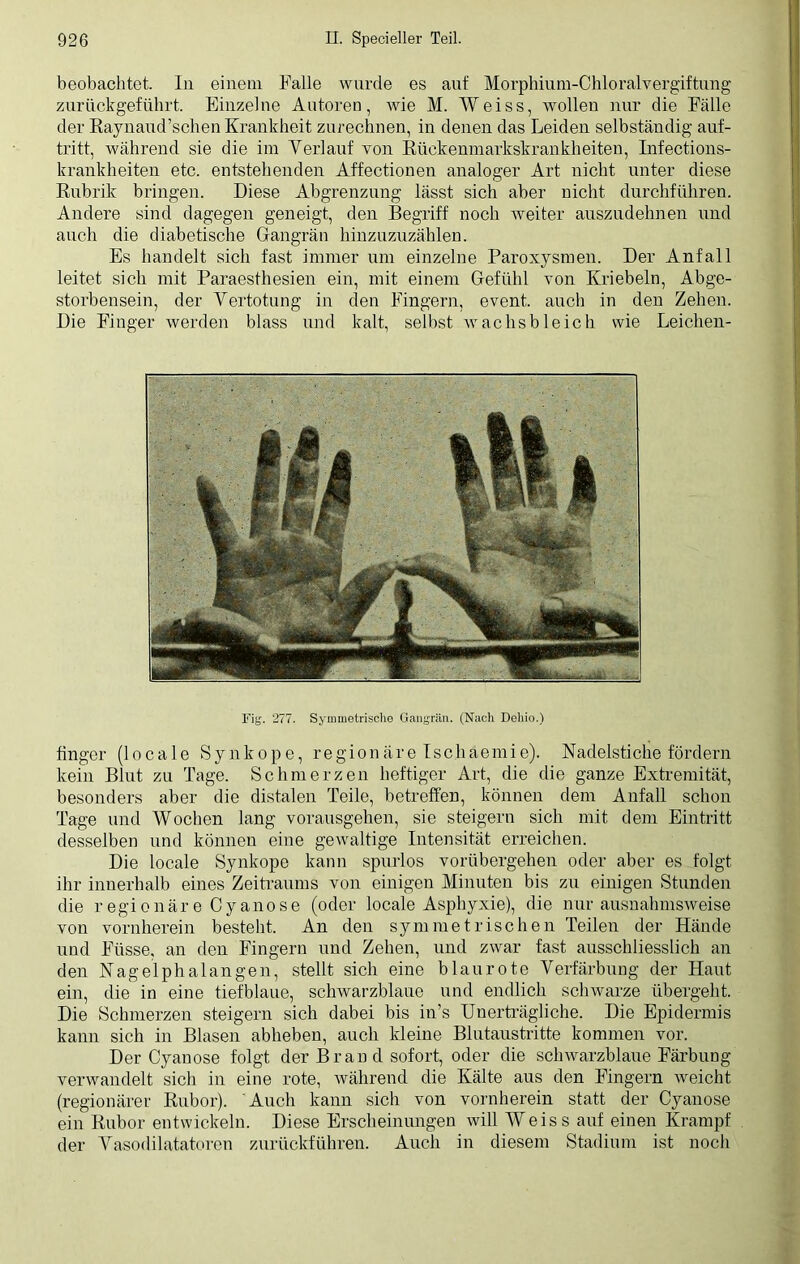 beobachtet. In einem Falle wurde es auf Morphium-Chloralvergiftung zurückgeführt. Einzelne Autoren, wie M. Weiss, wollen nur die Fälle der Raynaud’schen Krankheit zurechnen, in denen das Leiden selbständig auf- tritt, während sie die im Verlauf von Rückemnarkskrankheiten, Infections- krankheiten etc. entstehenden Affectionen analoger Art nicht unter diese Rubrik bringen. Diese Abgrenzung lässt sich aber nicht durchführen. Andere sind dagegen geneigt, den Begriff noch weiter auszudehnen und auch die diabetische Gangrän hinzuzuzählen. Es handelt sich fast immer um einzelne Paroxysmen. Der Anfall leitet sich mit Paraesthesien ein, mit einem Gefühl von Kriebeln, Abge- storbensein, der Vertotung in den Fingern, event. auch in den Zehen. Die Finger werden blass und kalt, selbst wrachsbleich wie Leichen- Fig. 277. Symmetrische Gangrän. (Nach Dehio.) finger (locale Synkope, regionäre Ischaemie). Nadelstiche fördern kein Blut zu Tage. Schmerzen heftiger Art, die die ganze Extremität, besonders aber die distalen Teile, betreffen, können dem Anfall schon Tage und Wochen lang vorausgehen, sie steigern sich mit dem Eintritt desselben und können eine gewaltige Intensität erreichen. Die locale Synkope kann spurlos vorübergehen oder aber es folgt ihr innerhalb eines Zeitraums von einigen Minuten bis zu einigen Stunden die regionäre Cyanose (oder locale Asphyxie), die nur ausnahmsweise von vornherein besteht. An den symmetrischen Teilen der Hände und Ftisse. an den Fingern und Zehen, und zwar fast ausschliesslich an den Nagelphalangen, stellt sich eine blaurote Verfärbung der Haut ein, die in eine tiefblaue, schwarzblaue und endlich schwarze übergeht. Die Schmerzen steigern sich dabei bis in’s Unerträgliche. Die Epidermis kann sich in Blasen abheben, auch kleine Blutaustritte kommen vor. Der Cyanose folgt der Bran d sofort, oder die schwarzblaue Färbung verwandelt sich in eine rote, während die Kälte aus den Fingern weicht (regionärer Rubor). Auch kann sich von vornherein statt der Cyanose ein Rubor entwickeln. Diese Erscheinungen will Weiss auf einen Krampf der Vasodilatatoren zurückführen. Auch in diesem Stadium ist noch