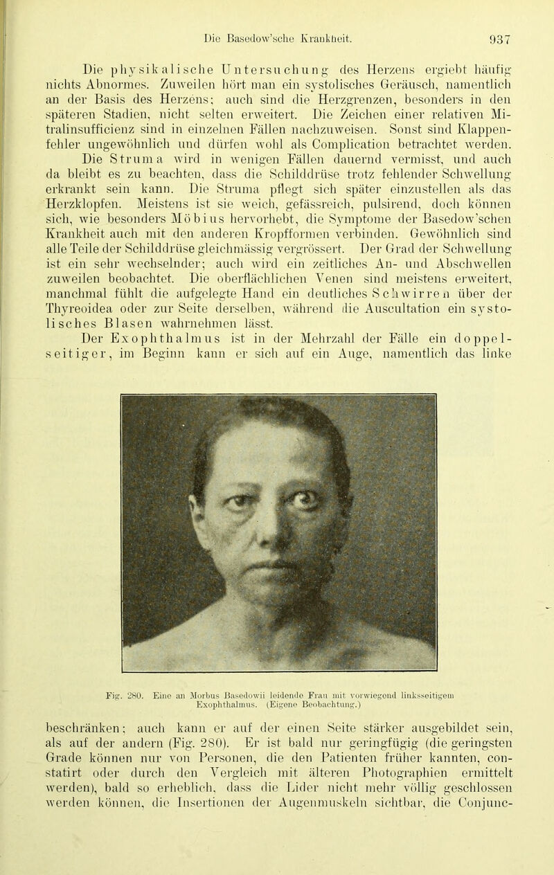 Die physikalische Untersuchung cles Herzens ergiebt häufig nichts Abnormes. Zuweilen hört man ein systolisches Geräusch, namentlich an der Basis des Herzens; auch sind die Herzgrenzen, besonders in den späteren Stadien, nicht selten erweitert. Die Zeichen einer relativen Mi- tralinsufficienz sind in einzelnen Fällen nachzuweisen. Sonst sind Klappen- fehler ungewöhnlich und dürfen wohl als Complication betrachtet werden. Die Struma wird in wenigen Fällen dauernd vermisst, und auch da bleibt es zu beachten, dass die Schilddrüse trotz fehlender Schwellung erkrankt sein kann. Die Struma pflegt sich später einzustellen als das Herzklopfen. Meistens ist sie weich, gefässreich, pulsirend, doch können sich, wie besonders Möbius hervorhebt, die Symptome der Basedow’schen Krankheit auch mit den anderen Kropfformen verbinden. Gewöhnlich sind alle Teile der Schilddrüse gleichnüissfg vergrössert. Der Grad der Schwellung ist ein sehr wechselnder; auch wird ein zeitliches An- und Abschwellen zuweilen beobachtet. Die oberflächlichen Venen sind meistens erweitert, manchmal fühlt die aufgelegte Hand ein deutliches S ch wir re n über der Thyreoidea oder zur Seite derselben, während die Auscultation ein systo- lisches Blasen wahrnehmen lässt. Der Exophthalmus ist in der Mehrzahl der Fälle ein doppel- seitiger, im Beginn kann er sich auf ein Auge, namentlich das linke Fig. 280. Eine an Morbus Basedowii leidende Frau mit vorwiegend linksseitigem Exophthalmus. (Eigene Beobachtung.) beschränken; auch kann er auf der einen Seite stärker ausgebildet sein, als auf der andern (Fig. 280). Er ist bald nur geringfügig (die geringsten Grade können nur von Personen, die den Patienten früher kannten, con- statirt oder durch den Vergleich mit älteren Photographien ermittelt werden), bald so erheblich, «lass die Lider nicht mehr völlig geschlossen werden können, die Insertionen der Augenmuskeln sichtbar, die Conjunc-
