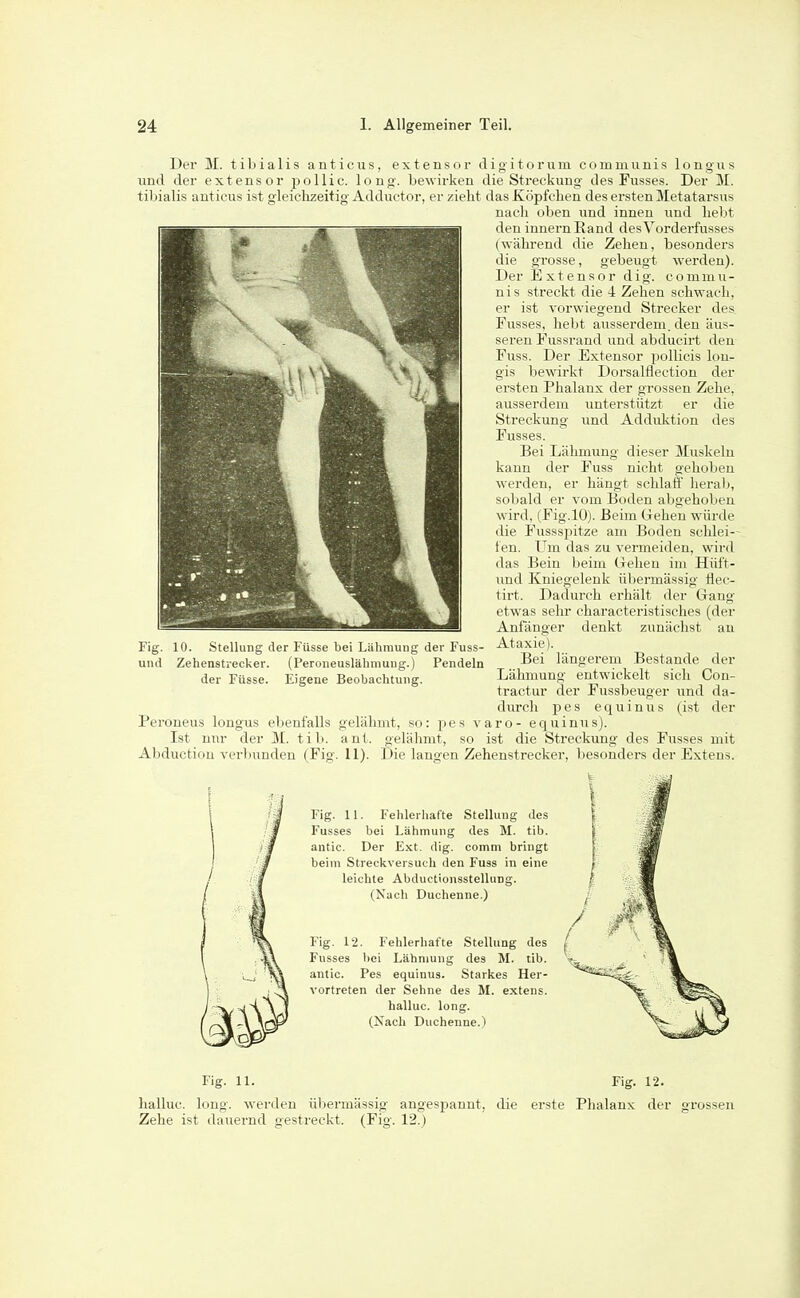 Dei M. tibialis anticus, extensor digitorum communis longus und der extensor pollic. long, bewirken die Streckung des Fusses. Der M. tibialis anticus ist gleichzeitig Adductor, er zieht das Köpfchen des ersten Metatarsus nach oben und innen und liebt den Innern Band desVorderfusses (während die Zehen, besonders die grosse, gebeugt werden). Der Extensor dig. commu- nis streckt die 4 Zehen schwach, er ist vorwiegend Strecker des Fusses, hebt ausserdem, den äus- seren Fussrand und abducirt den Fuss. Der Extensor pollicis lou- gis bewirkt Dorsalflection der ersten Phalanx der grossen Zehe, ausserdem unterstützt er die Streckung und Adduktion des Fusses. Bei Lähmung dieser Muskeln kann der Fuss nicht gehoben werden, er hängt schlaff heralj, sobald er vom Boden abgehoben wird, (Fig.lO). Beim Grehen würde die Fussspitze am Boden schlei-- fen. Um das zu vermeiden, wird das Bein beim treheu im Hüft- und Kniegelenk übermässig Hec- tirt. Dadurch erhält der Gang etwas sehr characteristisches (der Anfänger denkt zunächst au Ataxie). Bei längerem Bestände der Lähmung entwickelt sich Con- tractur der Fussbeuger und da- durch pes equinus (ist der Peroneus longus ebenfalls gelähmt, so: pes v a r o - equinus). Ist nur der M. tib. ant. gelähmt, so ist die Streckung des Fusses mit Abduction verbunden (Fig. 11). Die langen Zehenstrecker, besondei-s der Extens. Fig. 11. Fehleiliafte Stellung des Fusses bei Lähmung tles M. tib. antic. Der Ext. dig. comni bringt beim Streckversuch den Fuss in eine leichte Abductionsstellung. (Nach Duchenne.) Fig. 10. Stellung der Füsse bei Lähmung der Fuss- und Zehenstrecker. (Peroneuslähmung.) Pendeln der Füsse. Eigene Beobachtung. Fig. 12. Fehlerhafte Stellung des Fusses bei Lähmung des M. tib. antic. Pes equinus. Starkes Her- vortreten der Sehne des M. extens. halluc. long. (Nach Duchenne.) Fig. 11. Fig. 12. halluc. long, werden übermässig angespannt, die erste Phalanx der grossen Zehe ist dauernd gestreckt. (Fig. 12.)