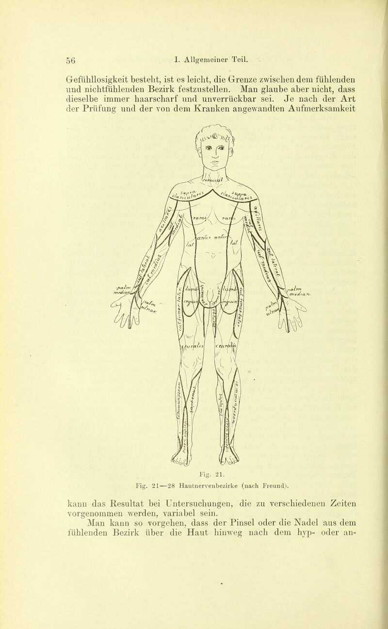 Gefühllosigkeit besteht, ist es leicht, die Grenze zwischen dem fühlenden imd nichtfühlenden Bezirk festzustellen. Man glaube aber nicht, dass dieselbe immer haarscharf und unverrückbar sei. Je nach der Art der Prüfung und der von dem Kranken angewandten Aufmerksamkeit Fig. 21. Fig. 21—28 Hautnerveiibezirlce (nach Freund). kann das Resultat bei Untersuchungen, die zu verschiedenen Zeiten vorgenommen werden, variabel sein. Mau kann so vorgehen, dass der Pinsel oder die Nadel aus dem fühlenden Bezirk über die Haut hinweg nach dem hyp- oder an-
