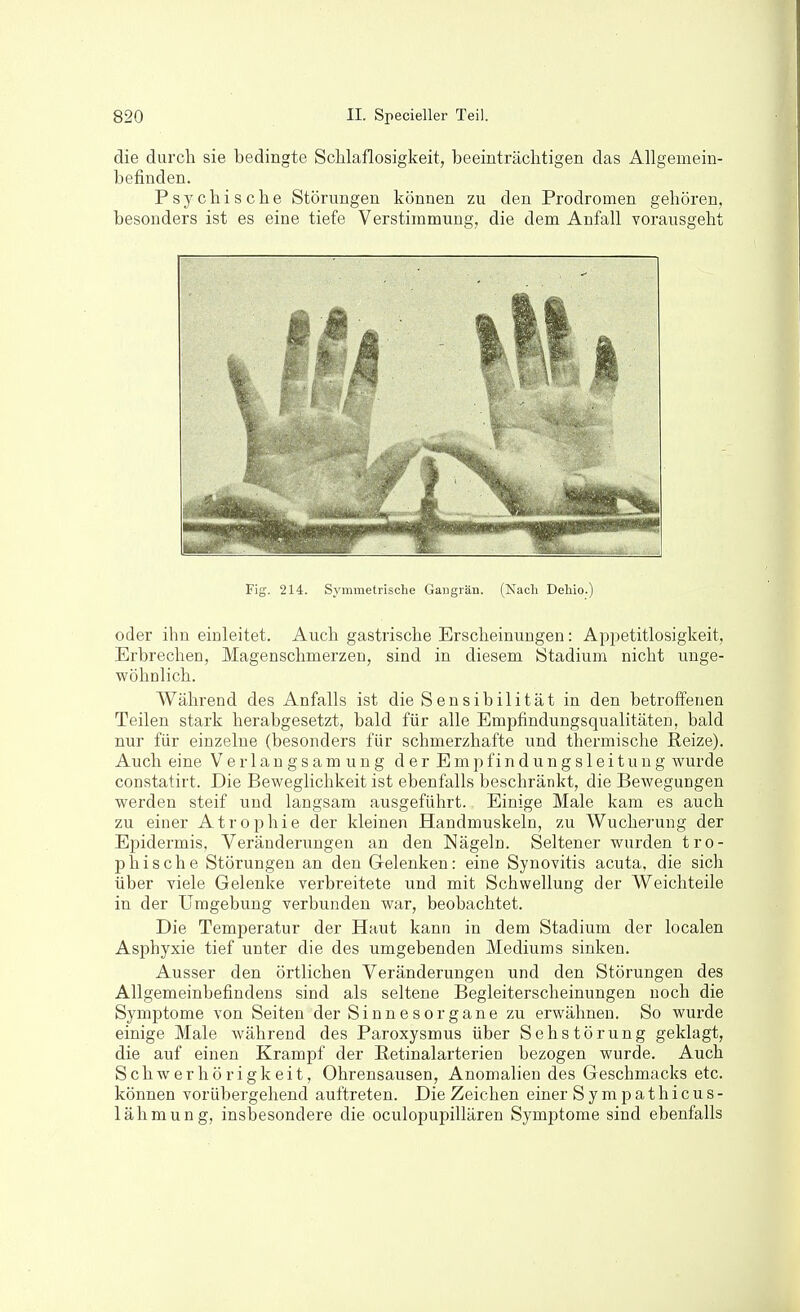 die durch sie bedingte Schlaflosigkeit, beeinträchtigen das Allgemein- befinden. Psychische Störungen können zu den Prodromen gehören, besonders ist es eine tiefe Verstimmung, die dem Anfall vorausgeht Fig. 214. Symmetrische Gangrän. (Nacli Dehio.) oder ihn einleitet. Auch gastrische Erscheinungen: Apjietitlosigkeit, Erbrechen, Magenschmerzen, sind in diesem Stadium nicht unge- wöhnlich. Während des Anfalls ist die Sensibilität in den betroffenen Teilen stark herabgesetzt, bald für alle Empfindungsqualitäten, bald nur für einzelne (besonders für schmerzhafte und thermische Reize). Auch eine Verlaugsamung der Empfindungsleituug wurde constatirt. Die Beweglichkeit ist ebenfalls beschränkt, die Bewegungen werden steif und langsam ausgeführt. Einige Male kam es auch zu einer Atrophie der kleinen Handmuskeln, zu Wucherung der Epidermis, Veränderungen an den Nägeln. Seltener wurden tro- p bis che Störungen an den Gelenken: eine Synovitis acuta, die sich über viele Gelenke verbreitete und mit Schwellung der Weichteile in der Umgebung verbunden war, beobachtet. Die Temperatur der Haut kann in dem Stadium der localen Asphyxie tief unter die des umgebenden Mediums sinken. Ausser den örtlichen Veränderungen und den Störungen des Allgemeinbefindens sind als seltene Begleiterscheinungen noch die Symptome von Seiten der Sinnesorgane zu erwähnen. So wurde einige Male während des Paroxysmus über Sehstörung geklagt, die auf einen Krampf der Eetinalarterien bezogen wurde. Auch Schwerhörigkeit, Ohrensausen, Anomalien des Geschmacks etc. können vorübergehend auftreten. Die Zeichen einer Sympathicus- lähmung, insbesondere die oculopupillären Symptome sind ebenfalls