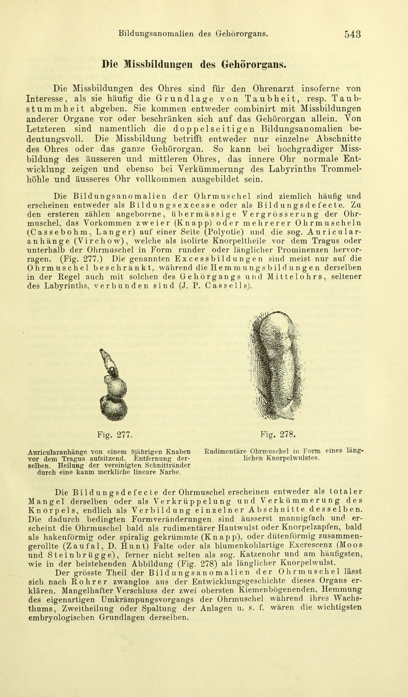 Die Missbildungen des Gehörorgans. Die Missbildungen des Ohres sind für den Ohrenarzt insoferne von Interesse, als sie häufig die Grundlage von Taubheit, resp. Taub- stummheit abgeben. Sie kommen entweder combinirt mit Missbildungen anderer Organe vor oder beschränken sich auf das Gehörorgan allein. Von Letzteren sind namentlich die doppelseitigen Bildungsanomalien be- deutungsvoll. Die Missbildung betrifft entweder nur einzelne Abschnitte des Ohres oder das ganze Gehörorgan. So kann bei hochgradiger Miss- bildung des äusseren und mittleren Ohres, das innere Ohr normale Ent- wicklung zeigen und ebenso bei Verkümmerung des Labyrinths Trommel- höhle und äusseres Ohr vollkommen ausgebildet sein. Die Bildungsanomalien der Ohrmuschel sind ziemlich häufig und erscheinen entweder als Bildungsexcesse oder als Bild ungsd efecte. Zu den ersteren zählen angeborene, übermässige Vergrösserung der Ohr- muschel, das Vorkommen zweier (Knapp) oder mehrerer Ohrmuscheln (Cassebohm, Langer) auf einer Seite (Pol3mtie) und die sog. Auricular- anhänge (Virchow), welche als isolirte Knorpeltheile vor dem Tragus oder unterhalb der Ohrmuschel in Form runder oder länglicher Prominenzen hervor- ragen. (Fig. 277.) Die genannten Excessbildungen sind meist nur auf die Ohrmuschel beschränkt, während die Hemmungsbildungen derselben in der Regel auch mit solchen des Gehörgangs und Mittelohrs, seltener des Labyrinths, verbunden sind (J. P. C a s s e 11 s). Auricularanhänge von einem 9jährigen Knahen Rudimentäre Ohrmuschel in Form eines läng- vor dem Tragus aufsitzend. Entfernung der- liehen Knorpelwulstes, seihen. Heilung der vereinigten Schnittränder durch eine kaum merkliche lineare Narhe. Die Bi 1 d un gs d efec t e der Ohrmuschel erscheinen entweder als totaler Mangel derselben oder als V'erkrüppelung und Verkümmerung des Knorpels, endlich als Verbildung einzelner Abschnitte desselben. Die dadurch bedingten Formveränderungen sind äusserst mannigfach und er- scheint die Ohrmuschel bald als rudimentärer Hautwulst oder Knorpelzapfen, bald als hakenförmig oder spiralig gekrümmte (Kn ap p), oder dütenförmig zusammen- gerollte (Zaufal, D. Hunt) Falte oder als blumenkohlartige Excrescenz (Moos und Steinbrügge), ferner nicht selten als sog. Katzenohr und am häufigsten, wie in der beistehenden Abbildung (Fig. 278) als länglicher Knorpelwulst. Der grösste Theil der Bildungsanomalien der Ohrmuschel lässt sich nach Rohr er zwanglos aus der Entwicklungsgeschichte dieses Organs er- klären. Mangelhafter Verschluss der zwei obersten Kiemenbögenenden, Hemmung des eigenartigen ümkrämpungsvorgangs der Ohrmuschel während ihres Wachs- thums, Zweitheilung oder Spaltung der Anlagen u. s. f. wären die wichtigsten embryologischen Grundlagen derselben. Fig. 277. Fig. 278,