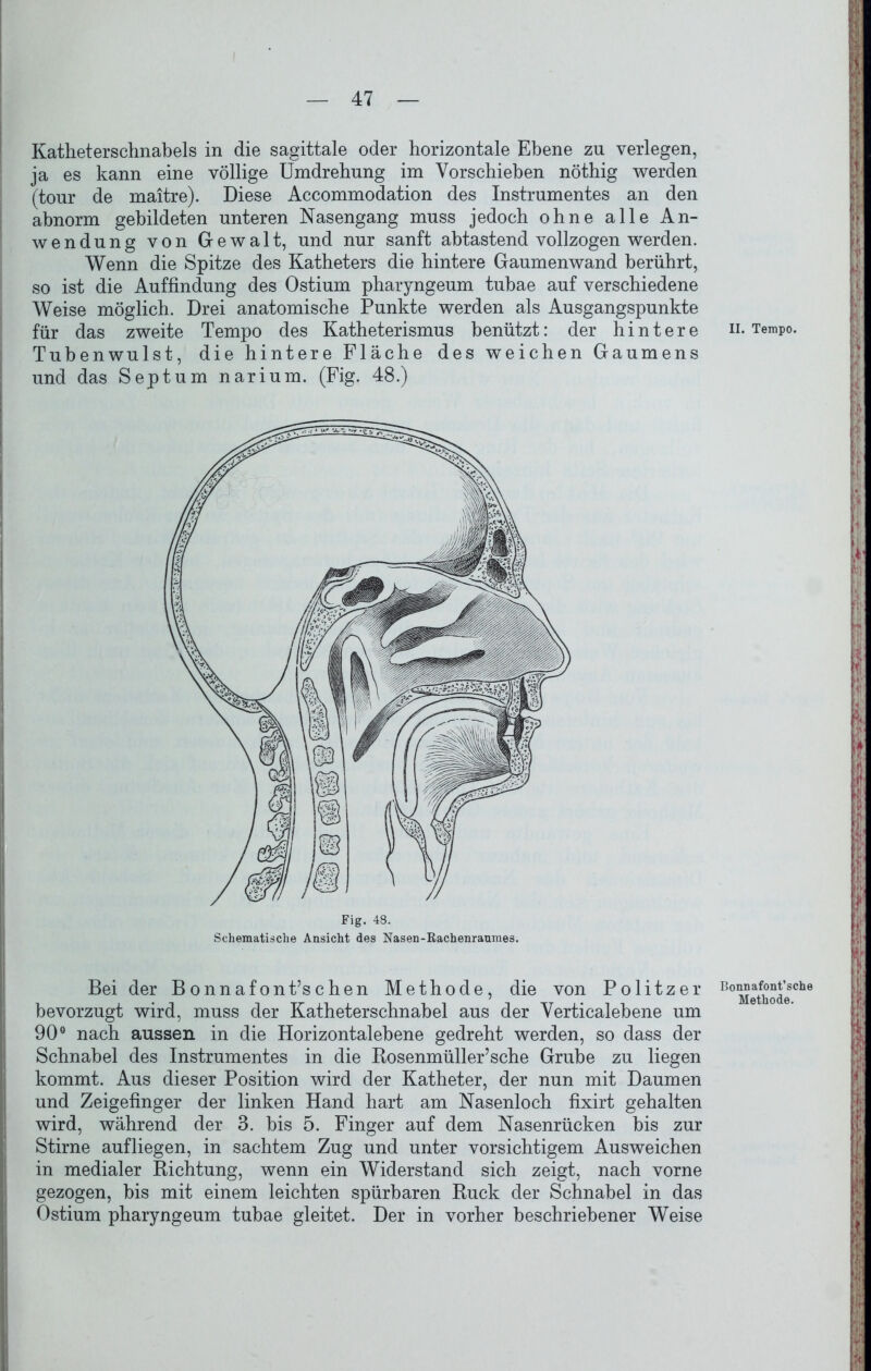 Katheterschnabels in die sagittale oder horizontale Ebene zu verlegen, ja es kann eine völlige Umdrehung im Yorschieben nöthig werden (tour de maitre). Diese Accommodation des Instrumentes an den abnorm gebildeten unteren Nasengang muss jedoch ohne alle An- wendung von Gewalt, und nur sanft abtastend vollzogen werden. Wenn die Spitze des Katheters die hintere Gaumenwand berührt, so ist die Auffindung des Ostium pharyngeum tubae auf verschiedene Weise möglich. Drei anatomische Punkte werden als Ausgangspunkte für das zweite Tempo des Katheterismus benützt: der hintere n. Tempo. Tubenwulst, die hintere Fläche des weichen Gaumens und das Septum narium. (Fig. 48.) Fig. 48. Schematische Ansicht des Nasen-Rachenranmes. Bei der Bonnafont’schen Methode, die von Politzer Bo Methode**0 bevorzugt wird, muss der Katheterschnabel aus der Verticalebene um 90° nach aussen in die Horizontal ebene gedreht werden, so dass der Schnabel des Instrumentes in die Rosenmüller’sche Grube zu liegen kommt. Aus dieser Position wird der Katheter, der nun mit Daumen und Zeigefinger der linken Hand hart am Nasenloch fixirt gehalten wird, während der 3. bis 5. Finger auf dem Nasenrücken bis zur Stirne auf liegen, in sachtem Zug und unter vorsichtigem Ausweichen in medialer Richtung, wenn ein Widerstand sich zeigt, nach vorne gezogen, bis mit einem leichten spürbaren Ruck der Schnabel in das Ostium pharyngeum tubae gleitet. Der in vorher beschriebener Weise