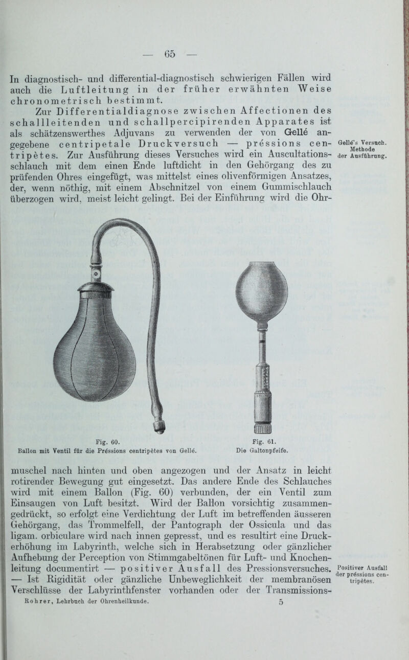 In diagnostisch- und differential-diagnostisch schwierigen Fällen wird auch die Luftleitung in der früher erwähnten Weise chronometrisch bestimmt. Zur Differentialdiagnose zwischen Affectionen des schallleitenden und schallpercipirenden Apparates ist als schätzenswerthes Adjuvans zu verwenden der von Gelle an- gegebene centripetale Druckversuch — pressions cen- GeU£*tJjJ®nch- tripetes. Zur Ausführung dieses Versuches wird ein Auscultations- der Ausführung, schlauch mit dem einen Ende luftdicht in den Gehörgang des zu prüfenden Ohres eingefügt, was mittelst eines olivenförmigen Ansatzes, der, wenn nöthig, mit einem Abschnitzel von einem Gummischlauch überzogen wird, meist leicht gelingt. Bei der Einführung wird die Ohr- Fig. 60. Fig. 61. Ballon mit Ventil für die Pressions centripetes von Gelle. Die Galtonpfeife. muschel nach hinten und oben angezogen und der Ansatz in leicht rotirender Bewegung gut eingesetzt. Das andere Ende des Schlauches wird mit einem Ballon (Fig. 60) verbunden, der ein Ventil zum Einsaugen von Luft besitzt. Wird der Ballon vorsichtig zusammen- gedrückt, so erfolgt eine Verdichtung der Luft im betreffenden äusseren Gehörgang, das Trommelfell, der Pantograph der Ossicula und das ligam. orbiculare wird nach innen gepresst, und es resultirt eine Druck- erhöhung im Labyrinth, welche sich in Herabsetzung oder gänzlicher Aufhebung der Perception von Stimmgabeltönen für Luft- und Knochen- leitung documentirt — positiver Ausfall des Pressionsversuches. Positiver Ausfall — Ist Kigidität oder gänzliche Unbeweglichkeit der membranösen der tripötes. Verschlüsse der Labyrinthfenster vorhanden oder der Transmissions- Rohr er, Lehrbuch der Ohrenheilkunde. 5