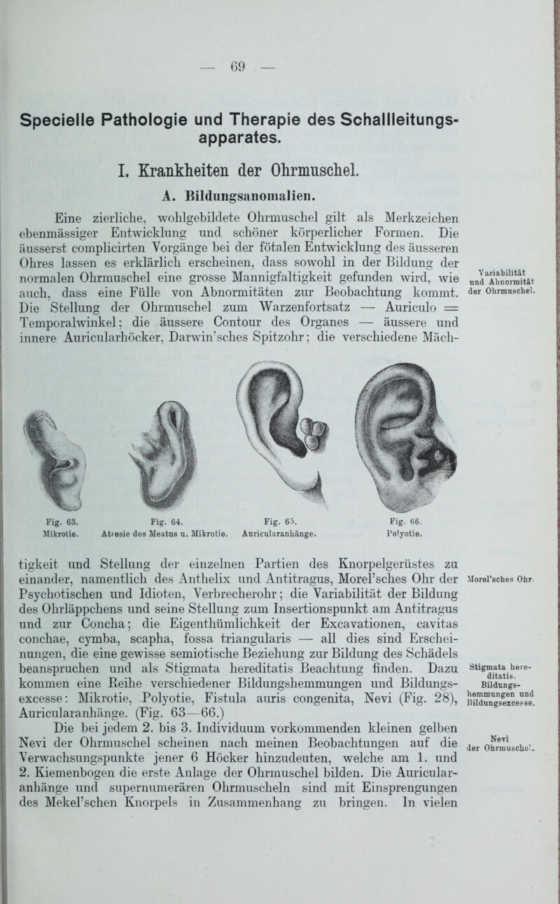 Specielle Pathologie und Therapie des Schallleitungs- apparates. I. Krankheiten der Ohrmuschel. A. Bildungsanomalien. Eine zierliche, wohlgebildete Ohrmuschel gilt als Merkzeichen ebenmässiger Entwicklung und schöner körperlicher Formen. Die äusserst complicirten Vorgänge bei der fötalen Entwicklung des äusseren Ohres lassen es erklärlich erscheinen, dass sowohl in der Bildung der normalen Ohrmuschel eine grosse Mannigfaltigkeit gefunden wird, wie auch, dass eine Fülle von Abnormitäten zur Beobachtung kommt. Die Stellung der Ohrmuschel zum Warzenfortsatz — Auriculo = Temporalwinkel; die äussere Contour des Organes — äussere und innere Auricularhöcker, Darwinsches Spitzohr; die verschiedene Mäch- Fig. 63. Mikrotie. Fig. 64. Atresie des Meatus u. Mikrotie. Fig. 65. Auricularanhänge. Fig. 66. Polyotie. tigkeit und Stellung der einzelnen Partien des Knorpelgerüstes zu einander, namentlich des Anthelix und Antitragus, MorePsches Ohr der Psychotischen und Idioten, Verbrecherohr; die Variabilität der Bildung des Ohrläppchens und seine Stellung zum Insertionspunkt am Antitragus und zur Concha; die Eigenthümlichkeit der Excavationen, cavitas conchae, cymba, scapha, fossa triangularis — all dies sind Erschei- nungen, die eine gewisse semiotische Beziehung zur Bildung des Schädels beanspruchen und als Stigmata hereditatis Beachtung finden. Dazu kommen eine Reihe verschiedener Bildungshemmungen und Bildungs- excesse: Mikrotie, Polyotie, Fistula auris congenita, Nevi (Fig. 28), Auricularanhänge. (Fig. 63—66.) Die bei jedem 2. bis 3. Individuum vorkommenden kleinen gelben Nevi der Ohrmuschel scheinen nach meinen Beobachtungen auf die Verwachsungspunkte jener 6 Höcker hinzudeuten, welche am 1. und 2. Kiemenbogen die erste Anlage der Ohrmuschel bilden. Die Auricular- anhänge und supernumerären Ohrmuscheln sind mit Einsprengungen des Mekel’schen Knorpels in Zusammenhang zu bringen. In vielen Variabilität und Abnormität der Ohrmuschel. Morel’sches Ohr Stigmata here- ditatis. Bildungs- hemmungen und Bildungsexcesse. Nevi