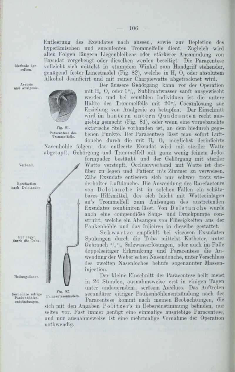 Methode der- selben. Asepsis und Analgesie. Verband. Karefaction nach Delstanche Spülungen durch die Tuba. Heilungsdauer. Secundäre eitrige Paukenhöhlen- entzündungen. Fig. 81. Paracentese des Trommelfells. Entleerung des Exsudates nach aussen, sowie zur Depletion des hyperämischen und succulenten Trommelfells dient. Zugleich wird allen Folgen langem Liegenbleibens oder stärkerer Ansammlung von Exsudat vorgebeugt oder dieselben werden beseitigt. Die Paracentese vollzieht sich mittelst in stumpfem Winkel zum Handgriff stehender, genügend fester Lancetnadel (Fig. 82), welche in H2 02 oder absolutem Alkohol desinficirt und mit reiner Charpiewatte abgetrocknet wird. Der äussere Gehörgang kann vor der Operation mit H2 02 oder l°/00 Sublimatwasser sanft ausgewischt werden und bei sensiblen Individuen ist die untere Hälfte des Trommelfells mit 20°/0 Cocainlösung zur Erzielung von Analgesie zu betupfen. Der Einschnitt wird im hintern untern Quadranten recht aus- giebig gemacht (Fig. 81), oder wenn eine vorgebauchte ektatische Stelle vorhanden ist, an dem hiedurch gege- benen Punkte. Der Paracentese lässt man sofort Luft- douche durch die mit H2 02 möglichst desinficirte Nasenhöhle folgen; das entleerte Exsudat wird mit steriler Watte abgetupft, Gehörgang und Trommelfell mit ganz wenig feinem Jodo- formpuder bestäubt und der Gehörgang mit steriler Watte verstopft, Occlusiwerband mit Watte ist dar- über zu' legen und Patient in’s Zimmer zu verweisen. Zähe Exsudate entleeren sich nur schwer trotz wie- derholter Luftdouche. Die Anwendung des Rarefacteurs von Delstanche ist in solchen Fällen ein schätz- bares Hilfsmittel, das sich leicht mit Watteeinlagen an’s Trommelfell zum Aufsaugen des austretenden Exsudates combiniren lässt. Von Delstanche wurde auch eine compendiöse Saug- und Druckpumpe c-on- struirt, welche ein Absaugen von Flüssigkeiten aus der Paukenhöhle Und das Injiciren in dieselbe gestattet. Schwartze empfiehlt bei viscösen Exsudaten Spülungen durch die Tuba mittelst Katheter, unter Gebrauch 3 4° 0 Salzwasserlösungen, oder auch im Falle doppelseitiger Erkrankung und Paracentese die An- wendung der Weber’schen Nasendouche, unter Verschluss des zweiten Nasenloches behufs sogenannter Massen- injection. Der kleine Einschnitt der Paracentese heilt meist in 24 Stunden, ausnahmsweise erst in einigen Tagen unter andauerndem, serösem Ausfluss. Das Auftreten secundärer eitriger Paukenhöhlenentzündung nach der Paracentese kommt nach meinen Beobachtungen, die sich mit den Angaben Politzer’s in Uebereinstimmung befinden, nur selten vor. Fast immer genügt eine einmalige ausgiebige Paracentese, und nur ausnahmsweise ist eine mehrmalige Vornahme der Operation nothwendig. Fig. 82. Paracentesennadeln.