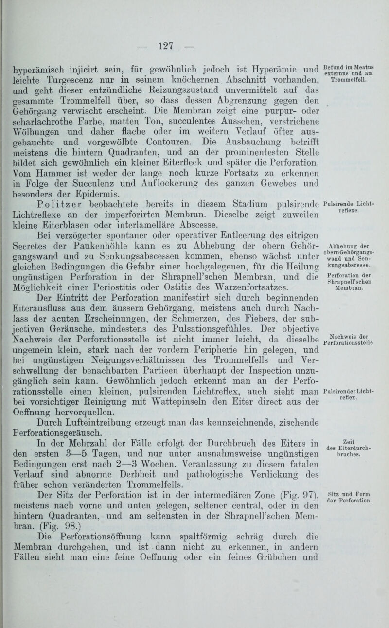 hyperämisch injicirt sein, für gewöhnlich jedoch ist Hyperämie und leichte Turgescenz nur in seinem knöchernen Abschnitt vorhanden, und geht dieser entzündliche Reizungszustand unvermittelt auf das gesammte Trommelfell über, so dass dessen Abgrenzung gegen den Gehörgang verwischt erscheint. Die Membran zeigt eine purpur- oder scharlachrothe Farbe, matten Ton, succulentes Aussehen, verstrichene Wölbungen und daher flache oder im weitern Verlauf öfter aus- gehauchte und vorgewölbte Contouren. Die Ausbauchung betrifft meistens die hintern Quadranten, und an der prominentesten Stelle bildet sich gewöhnlich ein kleiner Eiterfleck und später die Perforation. Vom Hammer ist weder der lange noch kurze Fortsatz zu erkennen in Folge der Succulenz und Auflockerung des ganzen Gewebes und besonders der Epidermis. Politzer beobachtete bereits in diesem Stadium pulsirende Lichtreflexe an der imperforirten Membran. Dieselbe zeigt zuweilen kleine Eiterblasen oder interlamelläre Abscesse. Bei verzögerter spontaner oder operativer Entleerung des eitrigen Secretes der Paukenhöhle kann es zu Abhebung der obern Gehör- gangswand und zu Senkungsabscessen kommen, ebenso wächst unter gleichen Bedingungen die Gefahr einer hochgelegenen, für die Heilung ungünstigen Perforation in der Shrapnell’schen Membran, und die Möglichkeit einer Periostitis oder Ostitis des Warzenfortsatzes. Der Eintritt der Perforation manifestirt sich durch beginnenden Eiterausfluss aus dem äussern Gehörgang, meistens auch durch Nach- lass der acuten Erscheinungen, der Schmerzen, des Fiebers, der sub- jectiven Geräusche, mindestens des Pulsationsgefühles. Der objective Nachweis der Perforationsstelle ist nicht immer leicht, da dieselbe ungemein klein, stark nach der vordem Peripherie hin gelegen, und bei ungünstigen NeigungsVerhältnissen des Trommelfells und Ver- schwellung der benachbarten Partieen überhaupt der Inspection unzu- gänglich sein kann. Gewöhnlich jedoch erkennt man an der Perfo- rationsstelle einen kleinen, pulsirenden Lichtreflex, auch sieht man bei vorsichtiger Reinigung mit Wattepinseln den Eiter direct aus der Oeffnung hervorquellen. Durch Lufteintreibung erzeugt man das kennzeichnende, zischende Perforationsgeräusch. In der Mehrzahl der Fälle erfolgt der Durchbruch des Eiters in den ersten 3—5 Tagen, und nur unter ausnahmsweise ungünstigen Bedingungen erst nach 2—3 Wochen. Veranlassung zu diesem fatalen Verlauf sind abnorme Derbheit und pathologische Verdickung des früher schon veränderten Trommelfells. Der Sitz der Perforation ist in der intermediären Zone (Fig. 97), meistens nach vorne und unten gelegen, seltener central, oder in den hintern Quadranten, und am seltensten in der ShrapnelFschen Mem- bran. (Fig. 98.) Die Perforationsöffnung kann spaltförmig schräg durch die Membran durchgehen, und ist dann nicht zu erkennen, in andern Fällen sieht man eine feine Oeffnung oder ein feines Grübchen und Befand im Meatus externus und am Trommelfell. Pulsirende Licht- reflexe Abhebung der obernGehörgangs- wand und Sen- feungsabscesse. Perforation der ShrapnelPschen Membran. Nachweis der Perforationsstelle Pulsirender Licht- reflex. Zeit des Eiterdurch- brnches. Sitz und Form der Perforation.