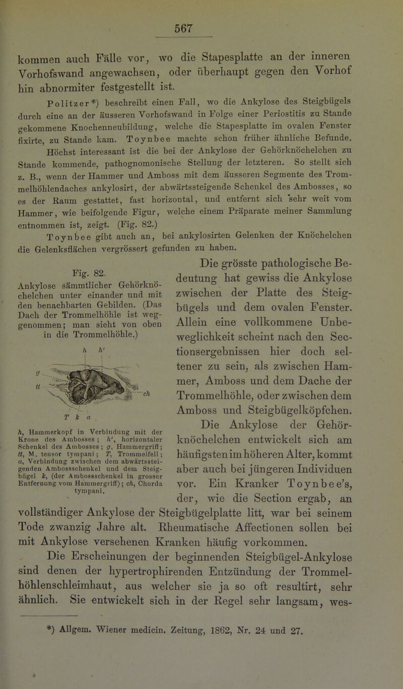 kommen auch Fälle vor, wo die Stapesplatte an der inneren Vorhofswand angewachsen, oder überhaupt gegen den Vorhof hin abnormiter festgestellt ist. Politzer* *) beschreibt einen Fall, wo die Ankylose des Steigbügels durch eine an der äusseren Vorhofswand in Folge einer Periostitis zu Stande gekommene Knoclienneubilduug, welche die Stapesplatte im ovalen Fenster tixirte, zu Stande kam. Toynbee machte schon früher ähnliche Befunde. Höchst interessant ist die bei der Ankylose der Gehörknöchelchen zu Stande kommende, patliognomonische Stellung der letzteren. So stellt sich z. B., wenn der Hammer und Amboss mit dem äusseren Segmente des Trom- melhöhlendaches ankylosirt, der abwärtssteigende Schenkel des Ambosses, so es der Raum gestattet, fast horizontal, und entfernt sich sehr weit vom Hammer, wie beifolgende Figur, welche einem Präparate meiner Sammlung entnommen ist, zeigt. (Fig. 82.) Toynbee gibt auch an, bei ankylosirten Gelenken der Knöchelchen die Gelenksflächen vergrössert gefunden zu haben. Die grösste pathologische Be- deutung hat gewiss die Ankylose zwischen der Platte des Steig- bügels und dem ovalen Fenster. Allein eine vollkommene Unbe- weglichkeit scheint nach den Sec- tionsergebnissen hier doch sel- tener zu sein, als zwischen Ham- mer, Amboss und dem Dache der Trommelhöhle, oder zwischen dem Amboss und Steigbügelköpfchen. Die Ankylose der Gehör- knöchelchen entwickelt sich am häufigsten im höheren Alter, kommt aber auch bei jüngeren Individuen vor. Ein Kranker Toynbee’s, der, wie die Section ergab, an vollständiger Ankylose der Steigbügelplatte litt, war bei seinem Tode zwanzig Jahre alt. Rheumatische Affectionen sollen bei mit Ankylose versehenen Kranken häufig Vorkommen. Die Erscheinungen der beginnenden Steigbügel-Ankylose sind denen der hypertrophirenden Entzündung der Trommel- höhlenschleimhaut, aus welcher sie ja so oft resultirt, sehr ähnlich. Sie entwickelt sich in der Regel sehr langsam, wes- Fig. 82. Ankylose sämmtlicher Gehörknö- chelchen unter einander und mit den benachbarten Gebilden. (Das Dach der Trommelhöhle ist weg- genommen; man sieht von oben in die Trommelhöhle.) h h' T k a h, Hammerkopf in Verbindung mit der Krone des Ambosses ; 7j', horizontaler Schenke] des Ambosses; (/, Hammergriff; tt, M. tensor tympani; T, Trommelfell; a, Verbindung zwischen dem abwärtsstei- genden Ambossscbenkel und dem Steig- bügel k, (der Ambossschenkel in grosser Entfernung vom Hammergriff); ch, Chorda tympani. * *) Allgem. Wiener medicin. Zeitung, 1862, Nr. 24 und 27.