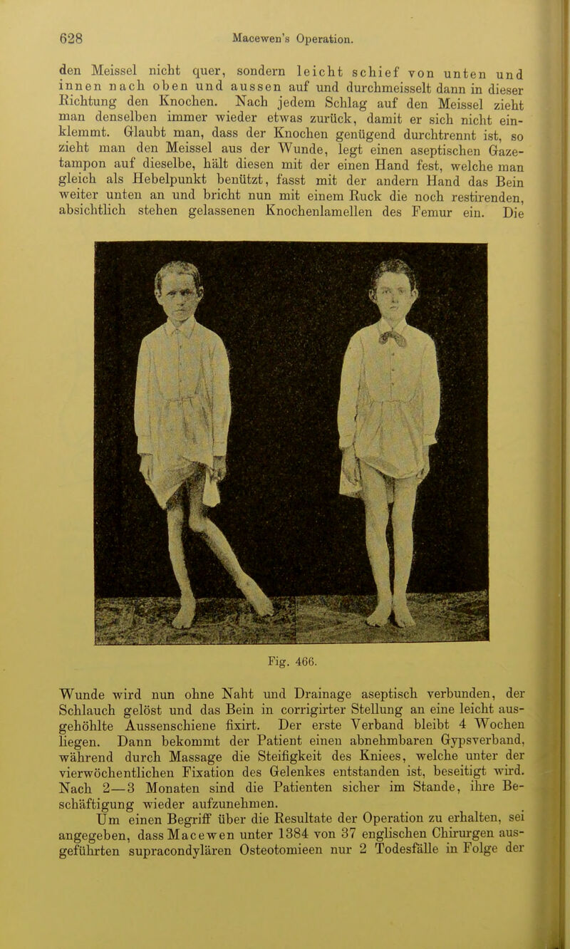 den Meissel nicht quer, sondern leicht schief von unten und innen nach oben und aussen auf und durchmeisselt dann in dieser Richtung den Knochen. Nach jedem Schlag auf den Meissel zieht man denselben immer wieder etwas zurück, damit er sich nicht ein- klemmt. Glaubt man, dass der Knochen genügend durchtrennt ist, so zieht man den Meissel aus der Wunde, legt einen aseptischen Gaze- tampon auf dieselbe, hält diesen mit der einen Hand fest, welche man gleich als Hebelpunkt benützt, fasst mit der andern Hand das Bein weiter unten an und bricht nun mit einem Ruck die noch restirenden, absichtlich stehen gelassenen Knochenlamellen des Femur ein. Die Fig. 466. Wunde wird nun ohne Naht und Drainage aseptisch verbunden, der Schlauch gelöst und das Bein in corrigirter Stellung an eine leicht aus- gehöhlte Aussenschiene fixirt. Der erste Verband bleibt 4 Wochen Hegen. Dann bekommt der Patient einen abnehmbaren Gypsverband, während durch Massage die Steifigkeit des Kniees, welche unter der vierwöchentlichen Fixation des Gelenkes entstanden ist, beseitigt wird. Nach 2—3 Monaten sind die Patienten sicher im Stande, ihre Be- schäftigung wieder aufzunehmen. Um einen Begriff über die Resultate der Operation zu erhalten, sei angegeben, dassMacewen unter 1384 von 37 englischen Chh-urgen aus- geführten supracondylären Osteotomieen nur 2 Todesfälle in Folge der