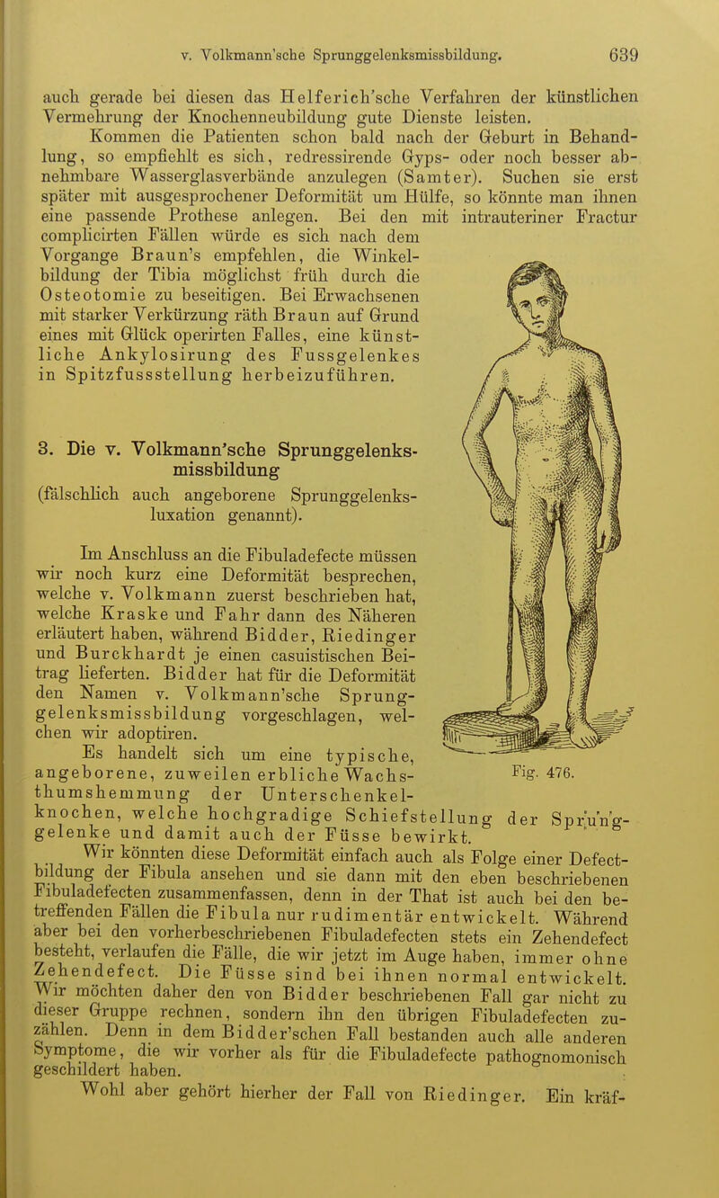 auch gerade bei diesen das Helferich'sche Verfahren der künstlichen Vermehrung der Knochenneubildung gute Dienste leisten. Kommen die Patienten schon bald nach der Geburt in Behand- lung, so empfiehlt es sich, redressirende Gryps- oder noch besser ab- nehmbare Wasserglasverbände anzulegen (Samter). Suchen sie erst später mit ausgesprochener Deformität um Hülfe, so könnte man ihnen eine passende Prothese anlegen. Bei den mit intrauteriner Fractur complicirten Fällen würde es sich nach dem Vorgange Braun's empfehlen, die Winkel- bildung der Tibia möglichst früh durch die Osteotomie zu beseitigen. Bei Erwachsenen mit starker Verkürzung räth Braun auf Grund eines mit Glück operirten Falles, eine künst- liche Ankylosirung des Fussgelenkes in Spitzfussstellung herbeizuführen. 3. Die V. Volkmann'sche Sprunggelenks- missbildung (fälschlich auch angeborene Sprunggelenks- luxation genannt). Im Anschluss an die Fibuladefecte müssen wir noch kurz eine Deformität besprechen, welche v. Volkmann zuerst beschrieben hat, welche Kraske und Fahr dann des Näheren erläutert haben, während Bidder, Riedinger und Burckhardt je einen casuistischen Bei- trag lieferten. Bidder hat für die Deformität den Namen v. Volkmann'sche Sprung- gelenksmissbildung vorgeschlagen, wel- chen wir adoptiren. Es handelt sich um eine typische, angeborene, zuweilen erbliche Wachs- Fig. 476. thumshemmung der Unterschenkel- knochen, welche hochgradige Schiefstellung der Sprung- gelenke und damit auch der Füsse bewirkt. Wir könnten diese Deformität einfach auch als Folge einer Defect- büdung der Fibula ansehen und sie dann mit den eben beschriebenen Fibuladetecten zusammenfassen, denn in der That ist auch bei den be- treffenden Fällen die Fibula nur rudimentär entwickelt. Während aber bei den vorherbeschriebenen Fibuladefecten stets ein Zehendefect besteht, verlaufen die Fälle, die wir jetzt im Auge haben, immer ohne Zehendefect. Die Füsse sind bei ihnen normal entwickelt. Wir möchten daher den von Bidder beschriebenen Fall gar nicht zu dieser Gruppe rechnen, sondern ihn den übrigen Fibuladefecten zu- zahlen. Denn m dem Bidder'schen Fall bestanden auch alle anderen Symptome, die wir vorher als für die Fibuladefecte pathognomonisch geschildert haben. Wohl aber gehört hierher der Fall von Rieding er. Ein kräf-