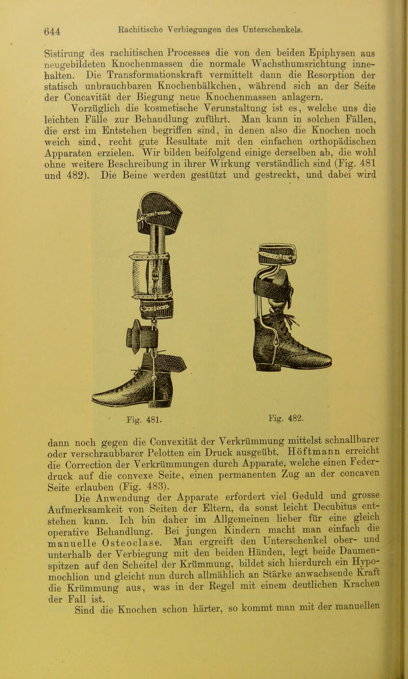Sistirimg des rachitisclien Processes die von den beiden Epiphysen aus neugebildeten Knochenmassen die normale Wacbsthumsricbtung inne- halten. Die Transformationskraft vermittelt dann die Resorption der statisch unbrauchbaren Knochenbälkchen, während sich an der Seite der Concavität der Biegung neue Knochenmassen anlagern. Vorzüglich die kosmetische Verunstaltung ist es, welche uns die leichten Fälle zur Behandlung zuführt. Man kann in solchen Fällen, die erst im Entstehen begriffen sind, in denen also die Knochen noch weich sind, recht gute Resultate mit den einfachen orthopädischen Apparaten erzielen. Wir bilden beifolgend einige derselben ab, die wohl ohne weitere Beschreibung in ihrer Wirkung verständlich sind (Fig. 481 und 482). Die Beine werden gestützt und gestreckt, und dabei wird Fig. 481. Fig. 482. dann noch gegen die Convexität der Verkrümmung mittelst schnallbarer oder verschraubbarer Pelotten ein Druck ausgeübt. Höftmann erreicht die Correction der Verkrümmungen durch Apparate, welche einen Feder- druck auf die convexe Seite, einen permanenten Zug an der concaven Seite erlauben (Fig. 483). Die Anwendung der Apparate erfordert viel Geduld und grosse Aufmerksamkeit von Seiten der Eltern, da sonst leicht Decubitus ent- stehen kann. Ich bin daher im Allgemeinen lieber für eine gleich operative Behandlung. Bei jungen Kindern macht man einfach die manuelle Osteoclase. Man ergreift den Unterschenkel ober- und unterhalb der Verbiegung mit den beiden Händen, legt beide Daumen- spitzen auf den Scheitel der Krümmung, bildet sich hierdurch ein Hypo- mochlion und gleicht nun durch allmählich an Stärke anwachsende Kratt die Krümmung aus, was in der Regel mit einem deutlichen Krachen der Fall ist. . Sind die Knochen schon härter, so kommt man mit der manueUen