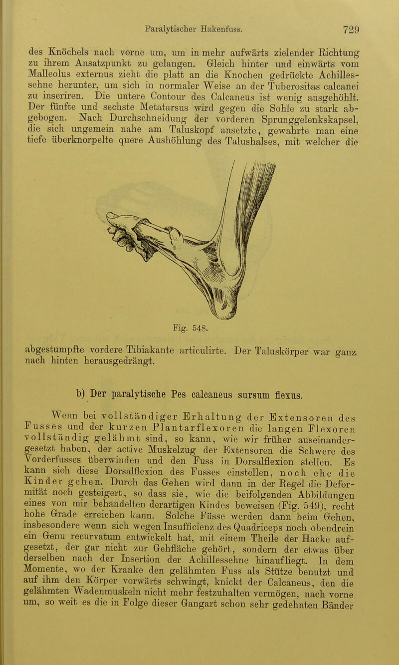 des Knöchels nach vorne um, um in mehr aufwärts zielender Richtung zu ihrem Ansatzpunkt zu gelangen. Gleich hinter und einwärts vom Malleolus externus zieht die platt an die Knochen gedrückte Achilles- sehne herunter, um sich in normaler Weise an der Tuberositas calcanei zu inseriren. Die untere Contour des Calcaneus ist wenig ausgehöhlt. Der fünfte und sechste Metatarsus wird gegen die Sohle zu stark ab- gebogen. Nach Durchschneidung der vorderen Sprunggelenkskapsel, die sich ungemein nahe am Taluskopf ansetzte, gewahrte man eine tiefe überknorpelte quere Aushöhlung des Talushalses, mit welcher die Fig. 548. abgestumpfte vordere Tibiakante articulirte. Der Taluskörper war ganz nach hinten herausgedrängt. b) Der paralytische Pes calcaneus sursum flexus. Wenn bei vollständiger Erhaltung der Extensoren des Fusses und der kurzen Plantarflexoren die langen Flexoren vollständig gelähmt sind, so kann, wie wir früher auseinander- gesetzt haben, der active Muskelzug der Extensoren die Schwere des Vorderfusses überwinden und den Fuss in Dorsalflexion stellen. Es kann sich diese Dorsalflexion des Fusses einstellen, noch ehe die Kinder gehen. Durch das Gehen wird dann in der Regel die Defor- niität noch gesteigert, so dass sie, wie die beifolgenden Abbildungen emes von mir behandelten derartigen Kindes beweisen (Fig. 549), recht hohe Grade erreichen kann. Solche Füsse werden dann beim Gehen, insbesondere wenn sich wegen Insufficienz des Quadriceps noch obendrein ein Genu recurvatum entwickelt hat, mit einem Theile der Hacke auf- gesetzt, der gar nicht zur Gehfläche gehört, sondern der etwas über derselben nach der Insertion der Achillessehne hinaufliegt. In dem Moniente, wo der Kranke den gelähmten Fuss als Stütze benutzt und auf ihm den Körper vorwärts schwingt, knickt der Calcaneus, den die gelähmten Wadenmuskeln nicht mehr festzuhalten vermögen, nach vorne um, so weit es die in Folge dieser Gangart schon sehr gedehnten Bänder