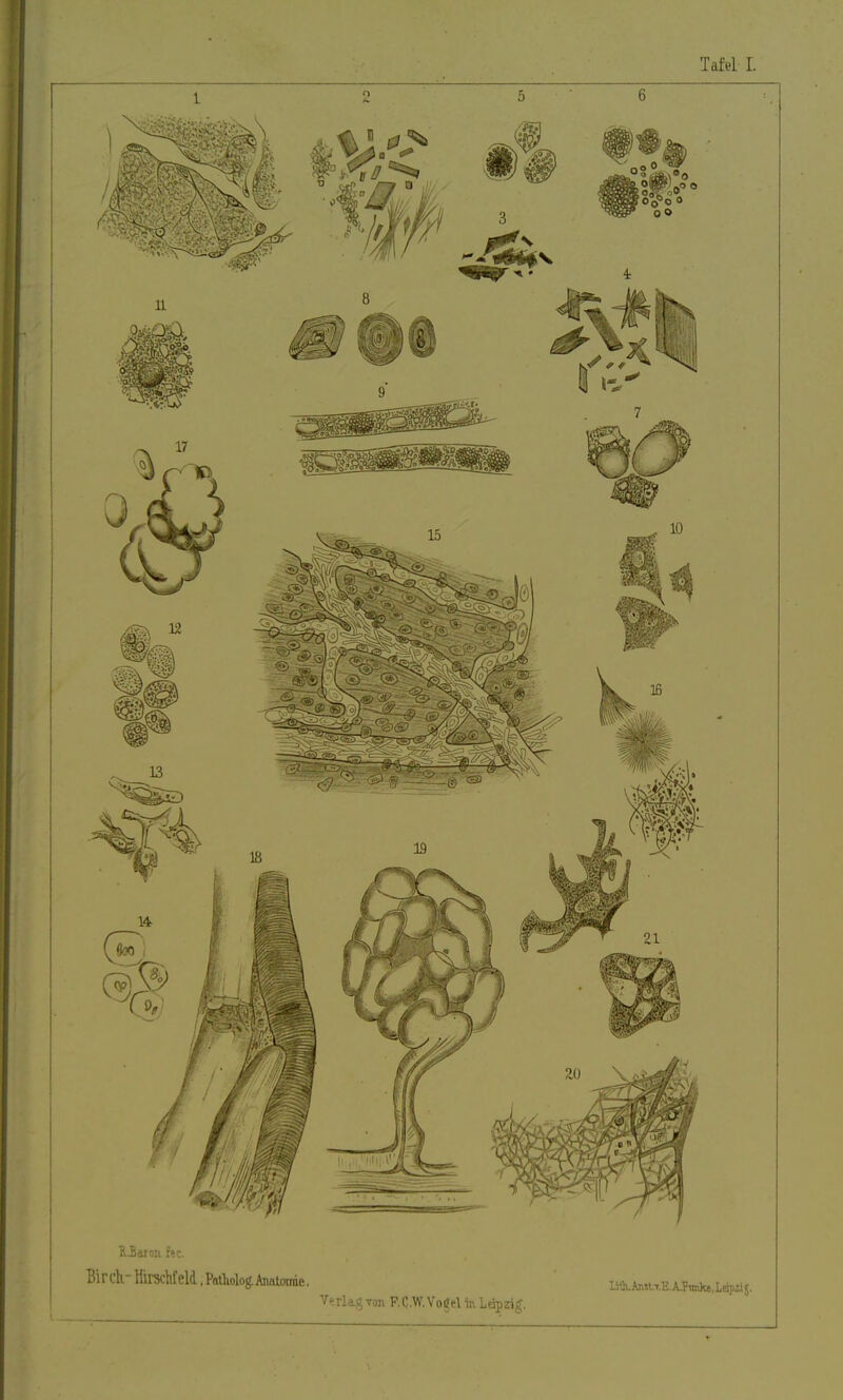 Oaron f«. Birch. Hirschfeld .Patholog. Anatomie. Verlag von R C.W. Vogel in Leipzig. Lith. Ansl.T.E. A.Fimke, lopii J.