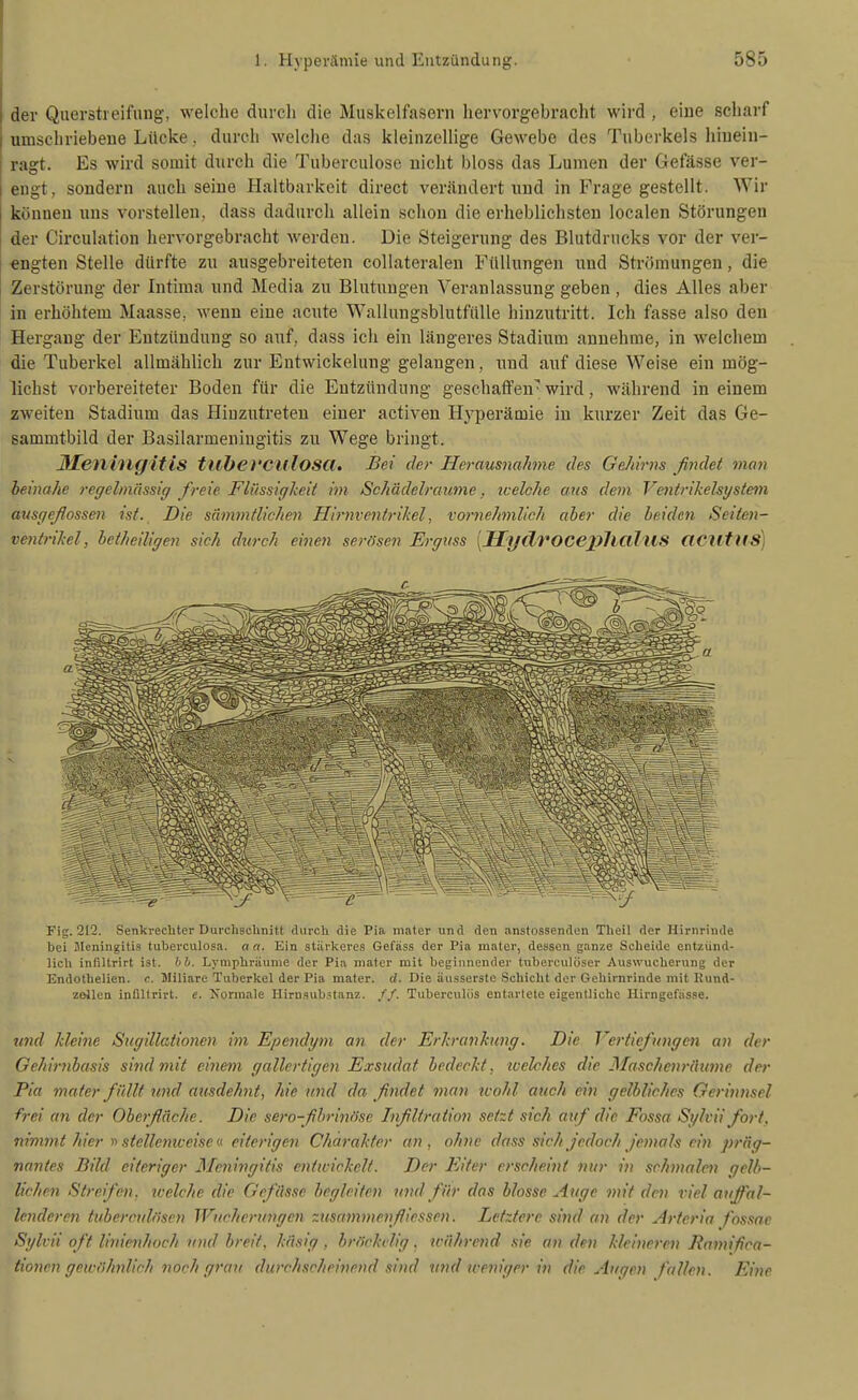j der Querstreifung, welche durch die Muskelfasern hervorgebracht wird , eine scharf i umschriebene Lücke, durch welche das kleinzellige Gewebe des Tuberkels liiuein- ragt. Es wird somit durch die Tuberculosc nicht bloss das Lumen der Gefässe ver- engt, sondern auch seine Haltbarkeit direct verändert und in Frage gestellt. Wir können uns vorstellen, dass dadurch allein schon die erheblichsten localen Störungen der Circulation hervorgebracht werden. Die Steigerung des Blutdrucks vor der ver- i engten Stelle dürfte zu ausgebreiteten collateralen Füllungen und Strömungen, die Zerstörung der Intima und Media zu Blutungen Veranlassung geben , dies Alles aber in erhöhtem Maasse, Avenn eine acute WallungsblutfüUe hinzutritt. Ich fasse also den Hergang der Entzündung so auf, dass ich ein längeres Stadium annehme, in welchem die Tuberkel allmählich zur Entwickelung gelangen, und auf diese Weise ein mög- lichst vorbereiteter Boden für die Entzündung geschaffen' wird, während in einem zweiten Stadium das Hinzutreten einer activen Hyperämie in kurzer Zeit das Ge- sammtbild der Basilarmeniugitis zu Wege bringt. 3£enlngitis tuberculosa. Bei der Herausnahme des Gehirns findet man beinahe regelmässig freie Flüssigkeit im Schädelraiinie, icelche aus dem Ventrikelsgstem ausgeflossen ist. Die swmmtlichen Hirnventrikel, vornehmlich aber die Leiden Seiten- venirikel, beiheiligen sich durch einen serösen Erguss [JBTydrocejyJlCllus aCUtUS) Fig. 212. Senki-echter Durchschnitt durch die Pia mater und den anstossenden Theil der Hirnrinde bei 5Ieningiti.s tuberculosa. a a. Ein starl<ere.s Gefäss der Pia mater, dessen ganze Scheide entzünd- lich infiUrirt ist. hb. LynipUräunie der Pia mater mit beginnender tubereulöser Auswucherung der Endotliellen. c. Willare Tuberkel der Pia mater. d. Die äusserste Schicht der Gehirnrinde mit Eund- zollen Infiltrirt. e, Normale Hirnsubstanz. //. Tuberculiis entartete eigentliche Hlrngefasse. u7id kleine Sugillationen im Ependym an der Erkrankung. Die Vertiefungen an der Gehirnbasis sind mit einem gallertigen Exsudat bedeckt, tcelches die Maschenriiume der Pia mater füllt und attsdehnt, hie und da findet man tvohl auch ein gelbliches Gerinnsel frei an der Oberfläche. Die sero-flhrinösc Inflltration setzt sich auf die Fossa Sglvii fort, nimmt hier >i stellemceise (( eiterigen Charakter an, ohne dass sich jedoch Jemals ein präg- nantes Bild eiteriger Meningitis entwickelt. Der Eiter erscheint nur in schjnalen gelb- lichen Streifen, welche die Gefässe hegleiten und für das blosse Auge mit den viel auffal- lenderen tuberculöseu Wucherungen msammcnflicssen. Letztere sind an der Arteria fossae Sglvii oft linienhnch und breit, käsig, bröckelig, während sie an den kleineren Ramifica- iionen gewöhnlich noch grau durchscheinend sind und weniger in die Augen fallen. Eine