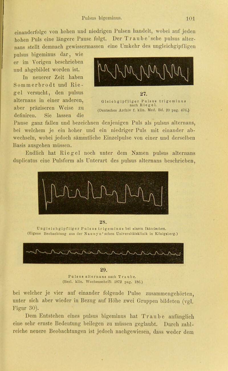 einanderfblge von hoben und niedrigen Pulsen handelt, wobei auf jeden hohen Puls eine längere Pause folgt. Der Traube'sehe puisus alter- nans stellt demnach gewissermassen eine Umkehr des ungleichgipfligen puisus bigeminus dar, wie er im Vorigen beschrieben und abgebildet worden ist. In neuerer Zeit haben Sommerbrodt und Rie- gel versucht, den piüsus 27. alternans in einer anderen, GieichgipfUger Puisus trigeminus , .. . „T • nneh Riegel, aber präziseren Weise zu (Deutsches Archiv f. klin. Med. Bd. 20 pag. 47G.) definii'en. Sie lassen die Pause ganz fallen und bezeichnen denjenigen Puls als puisus alternans, bei welchem je ein hoher und ein niedriger Puls mit einander ab- wechseln, wobei jedoch sämmtliche Einzelpulse von einer und derselben Basis ausgehen müssen. Endlich hat Riegel noch unter dem Namen puisus alternans duplicatus eine Pulsform als Unterart des puisus alternans beschrieben. 28. Ungleichgipfliger Pulsns trigeminus bei einem Ilitorischen. (Eigene Beobachtung aus der Naunyn'sehen Universitätslslinilt in Königsberg.) 29. Puisus alternans nach Traube. (Berl. klin. Wochenschrift 1872 pag. 18G.) bei welcher je vier auf einander folgende Pulse zusammengehörten, unter sich aber wieder in Bezug auf Höhe zwei Gruppen bildeten (vgl. Figur .30). Dem Entstehen eines puisus bigeminus hat Traube anfänglich eine sehr ernste Bedeutung beilegen zu müssen geglaubt. Durch zahl- reiche neuere Beobachtungen ist jedoch nachgewiesen, dass weder dem