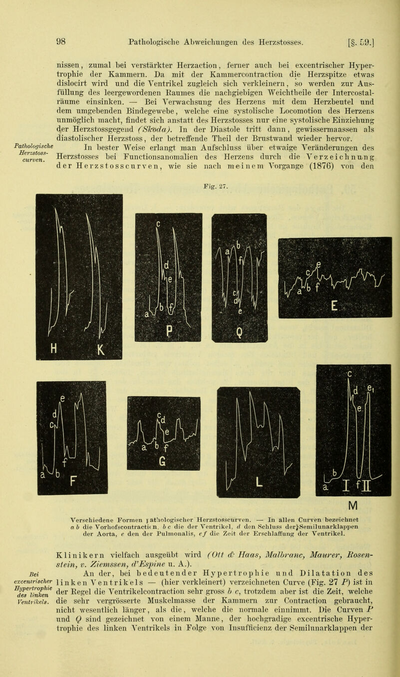 nissen, zumal bei verstärkter Herzaction, ferner auch bei excentrischer Hyper- trophie der Kammern. Da mit der Kammercontraction die Herzspitze etwas dislocirt wird und die Ventrikel zugleich sich verkleinern, so werden zur Aus- füllung des leergewordenen Raumes die nachgiebigen Weichtheile der Intercostal- räume einsinken. — Bei Verwachsung des Herzens mit dem Herzbeutel und dem umgebenden Bindegewebe, welche eine systolische Locomotion des Herzens unmöglich macht, findet sich anstatt des Herzstosses nur eine sj'stolische Einziehung der Herzstossgegend (Sk'oda). In der Diastole tritt dann, gewissermaassen als diastolischer Herzstoss, der betreffende Theil der Brustwand wieder hervor. Pamoiogische In bester Weise erlangt man Aufschluss über etwaige Veränderungen des curvmT Herzstosses bei Functionsanomalien des Herzens durch die Verzeichnung der Herzstosscurven, wie sie nach meinem Vorgange (1876) von den Fig. 27. Verschiedene Formen j ätiologischer Herzstosscurven. — In allen Curven bezeichnet a b die Vorhofscontracti( n, bc die der Ventrikel, ä den »Schluss derjSemilunarklappen der Aorta, c den der Pulmonalis, ef die Zeit der Erschlaffung der Ventrikel. Klinikern vielfach ausgeübt Avird (Ott d- Haas, Malhranc, Maurer, Rosen- siein, V. Ziemssen, d'Esjnne u. A.). Bei An der, bei bedeutender Hypertrophie und Dilatation des excentrischer linken Ventrikels — (hier verkleinert) verzeichneten Curve (Fig. 27 F) ist in ^dlTSen Regel die Ventrikelcontraction sehr gross h c, trotzdem aber ist die Zeit, welche Venirikeis. die sehr vergrösserte Muskelmasse der Kammern zur Contraction gebraucht, nicht wesentlich länger, als die, welche die normale einnimmt. Die Curven F und Q sind gezeichnet von einem Manne, der hochgradige excentrische Hyper- trophie des linken A-entrikels in Folge von Insufficienz der Semilunarklappen der