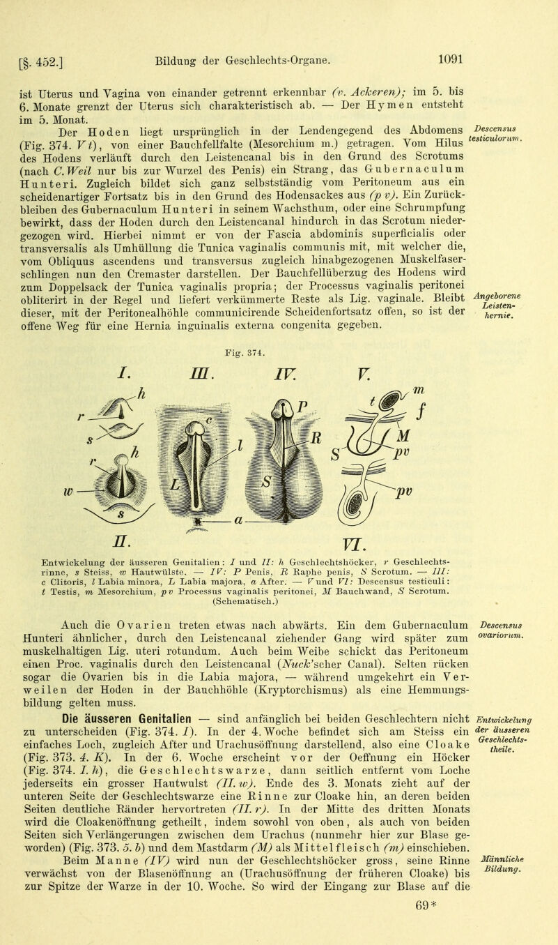 ist Uterus und Vagina von einander getrennt erkennbar (v. Ackeren); im 5. bis 6. Monate grenzt der Uterus sich charakteristisch ab. — Der Hymen entsteht im 5. Monat. Der Hoden liegt ursprünglich in der Lendengegend des Abdomens Descensus (Fig. 374. Vt), von einer Bauchfellfalte (Mesorchium m.) getragen. Vom Hilus des Hodens verläuft durch den Leistencanal bis in den Grund des Scrotums (nach C.Weü nur bis zur Wurzel des Penis) ein Strang, dasGubernaculum Hu uteri. Zugleich bildet sich ganz selbstständig vom Peritoneum aus ein scheidenartiger Fortsatz bis in den Grund des Hodensackes aus (p v). Ein Zurück- bleiben des Gubernaculum Hu uteri in seinem Wachsthum, oder eine Schrumpfung bewirkt, dass der Hoden durch den Leistencanal hindurch in das Scrotum nieder- gezogen wird. Hierbei nimmt er von der Fascia abdominis superficialis oder transversalis als Umhüllung die Tunica vaginalis communis mit, mit welcher die, vom Obliquus ascendens und transversus zugleich hinabgezogenen Muskelfaser- schlingen nun den Cremaster darstellen. Der Bauchfellüberzug des Hodens^ wird zum Doppelsack der Tunica vaginalis propria; der Processus vaginalis peritonei obliterirt in der Eegel und liefert verkümmerte Reste als Lig. vaginale. Bleibt ^Ye*S-* dieser, mit der Peritonealhöhle communicirende Scheidenfortsatz offen, so ist der hirni^' offene Weg für eine Hernia inguinalis externa congenita gegeben. Entwickelung der äusseren Genitalien: I nnd //; h Geschlechtshöcker, r Geschlechts- rinne, s Steiss, w Hautwülste. — IV: P Penis, J? Eaphe penis, ^i Scrotum. — III: c Clitoris, Z Labia minora, L Labia majora, a After. — Tund VI: Descensus testiculi: t Testis, m Mesorchium, pv Processus vaginalis peritonei, M Bauchwand, S Scrotum. (Scbematisch.) Auch die Ovarien treten etwas nach abwärts. Ein dem Gubernaculum Descensus Hunteri ähnlicher, durch den Leistencanal ziehender Gang wird später zum ovanorum. muskelhaltigen Lig. uteri rotundum. Auch beim Weibe schickt das Peritoneum einen Proc. vaginalis durch den Leistencanal (A%cÄ;'scher Canal). Selten rücken sogar die Ovarien bis in die Labia majora, — während umgekehrt ein Ver- weilen der Hoden in der Bauchhöhle (Kryptorchismus) als eine Hemmungs- bildung gelten muss. Die äusseren Genitalien — sind anfänglich bei beiden Geschlechtern nicht Entwickelung zu unterscheiden (Fig. 374./). In der 4. Woche befindet sich am Steiss Q\n der äusseren einfaches Loch, zugleich After und Urachusöffnung darstellend, also eine Cloake ^^theiie.^^' (Fig. 373. 4. In der 6. Woche erscheint vor der Oeffnung ein Höcker (Fig. 374. J./i), die Geschlechtswarze, dann seitlich entfernt vom Loche jederseits ein grosser Hautwulst (IL w). Ende des 3. Monats zieht auf der unteren Seite der Geschlechtswarze eine Rinne zur Cloake hin, an deren beiden Seiten deutliche Ränder hervortreten (II. r). In der Mitte des dritten Monats wird die Cloakenöffnung getheilt, indem sowohl von oben, als auch von beiden Seiten sich Verlängerungen zwischen dem Urachus (nunmehr hier zur Blase ge- worden) (Fig. 373. 5. V) und dem Mastdarm (M) als Mittelfleisch (m) einschieben. Beim Manne (lY) wird nun der Geschlechtshöcker gross, seine Rinne Männliche verwächst von der Blasenöffnung an (Urachusöffnung der früheren Cloake) bis ^^^dung. zur Spitze der Warze in der 10. Woche. So wird der Eingang zur Blase auf die 69*