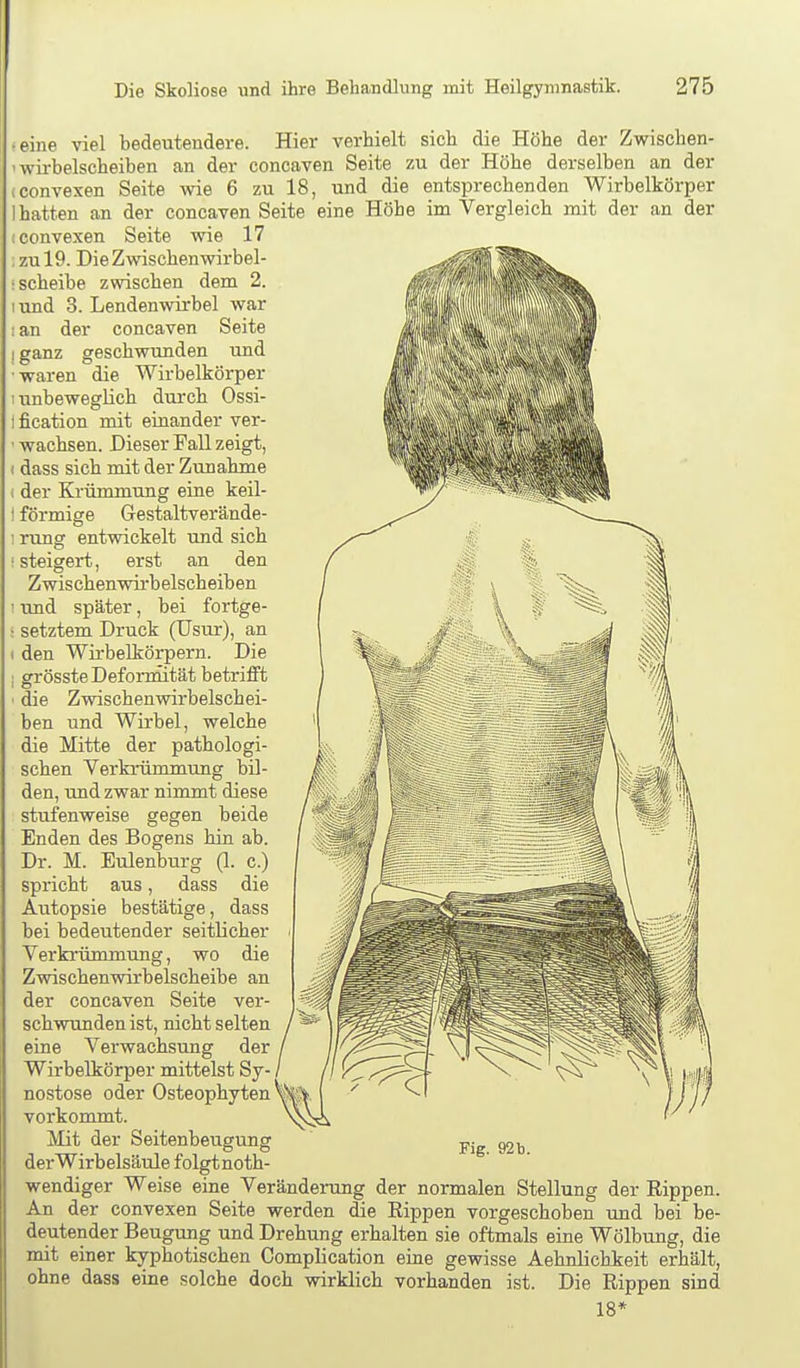 (eine viel bedeutendere. Hier verhielt sich die Höhe der Zwischen- iwü-belscheiben an der concaven Seite zu der Höhe derselben an der (convexen Seite wie 6 zu 18, und die entsprechenden Wirbelkörper 1 hatten an der concaven Seite eine Höhe im Vergleich mit der an der (convexen Seite wie 17 zu 19. Die Zwischenwirbel- : Scheibe zwischen dem 2. I und 3. Lendenwirbel war •an der concaven Seite I ganz geschwunden und waren die Wirbelkörper I unbeweglich durch Ossi- tfication mit einander ver- ' wachsen. Dieser Fall zeigt, I dass sich mit der Zunahme ( der Krümmung eine keil- t förmige Gestaltverände- 1 rung entwickelt und sich ■ steigert, erst an den Zwischenwirbelscheiben ' und später, bei fortge- : setztem Druck (Usur), an ( den Wirbelkörpern. Die : grösste Deforniität betrifft ' die Zwischenwirbelschei- ben und Wirbel, welche die Mitte der pathologi- schen Verkrümmung bil- den, und zwar nimmt diese stufenweise gegen beide Enden des Bogens hin ab. Dr. M. Eulenburg (1. c.) spricht aus, dass die Autopsie bestätige, dass bei bedeutender seitlicher Verkrümmung, wo die Zwischenwirbelscheibe an der concaven Seite ver- schwunden ist, nicht selten eine Verwachsung der Wirbelkörper mittelst Sy- nostose oder Osteophyten vorkommt. Mit der Seitenbeugung derWirbelsäule folgtnoth Fig. 92b. wendiger Weise eine Veränderung der normalen Stellung der Rippen. An der convexen Seite werden die Rippen vorgeschoben und bei be- deutender Beugung und Drehung erhalten sie oftmals eine Wölbung, die mit einer kyphotischen Complication eine gewisse Aehnlichkeit erhält, ohne dass eine solche doch wirklich vorhanden ist. Die Rippen sind 18*