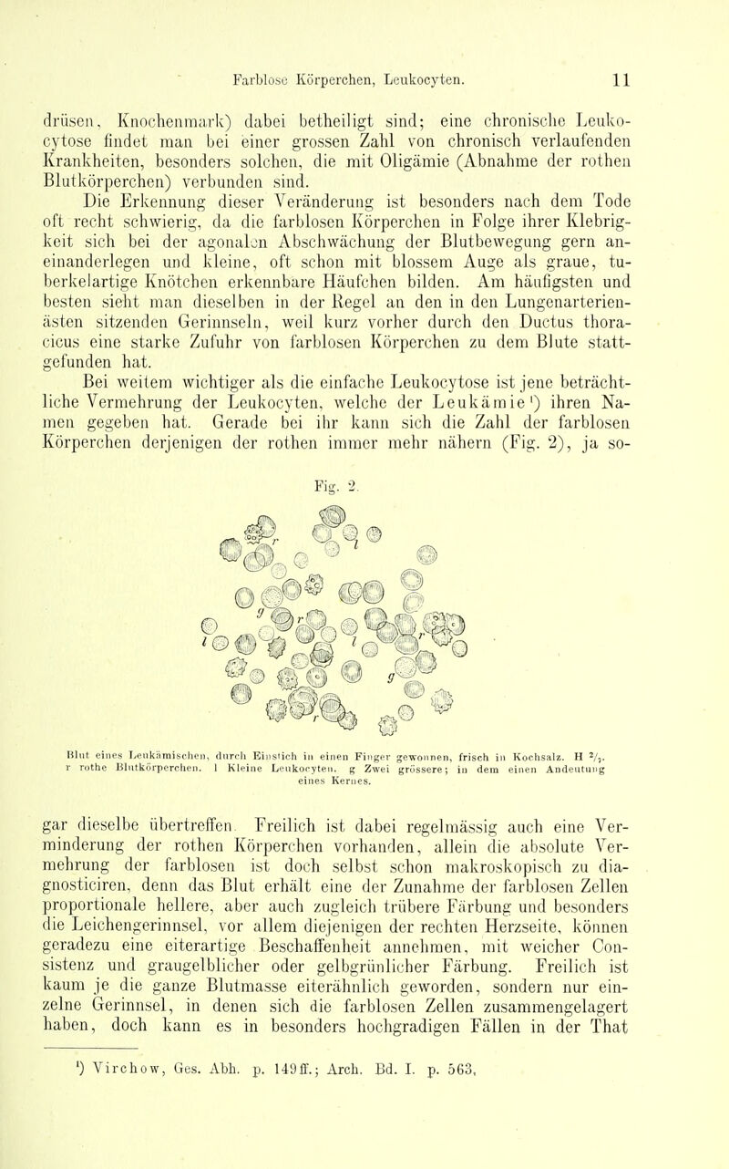 drüseii, Knochenniiivk) dabei betheiligt sind; eine chronisclie Leuko- cytose findet man bei einer grossen Zahl von chronisch verlaufenden Krankheiten, besonders solchen, die mit Oligämie (Abnahme der rothen Blutkörperchen) verbunden sind. Die Erkennung dieser Veränderung ist besonders nach dem Tode oft recht schwierig, da die farblosen Körperchen in Folge ihrer Klebrig- keit sich bei der agonalon Abschwächung der Blutbevvegung gern an- einanderlegen und kleine, oft schon mit blossem Auge als graue, tu- berkelartige Knötchen erkennbare Häufchen bilden. Am häufigsten und besten sieht man dieselben in der Regel an den in den Lungenarterien- ästen sitzenden Gerinnseln, weil kurz vorher durch den Ductus thora- cicus eine starke Zufuhr von farblosen Körperchen zu dem Blute statt- gefunden hat. Bei weitem wichtiger als die einfache Leukocytose ist jene beträcht- liche Vermehrung der Leukocyten, welche der Leukämie') ihren Na- men gegeben hat. Gerade bei ibr kann sich die Zahl der farblosen Körperchen derjenigen der rothen immer mehr nähern (Fig. 2), ja so- BUit eines Leiikäraischeii, diircli Eiiisiich iji einen Finger gewonnen, frisch in Kochsalz. H V,. r rothe Blutkörperchen. 1 Kleine Leukocyten. g Zwei grössere; in dem einen Andeutung eines Kernes. gar dieselbe übertreffen^ Freilich ist dabei regelmässig auch eine Ver- minderung der rothen Körperchen vorhanden, allein die absolute Ver- mehrung der farblosen ist doch selbst schon makro.skopi.sch zu dia- gnosticiren, denn das Blut erhält eine der Zunahme der farblosen Zellen proportionale hellere, aber auch zugleich trübere Färbung und besonders die Leichengerinnsel, vor allem diejenigen der rechten Herzseite, können geradezu eine eiterartige Beschaffenheit annehmen, mit weicher Con- sistenz und graugelblicher oder gelbgrünlicher Färbung. Freilich ist kaum je die ganze Blutraasse eiterähnlich geworden, sondern nur ein- zelne Gerinnsel, in denen sich die farblosen Zellen zusammengelagert haben, doch kann es in besonders hochgradigen Fällen in der That ') Virchow, Ges. Abb. p. 149ff.; Arcb. Bd. I. p. 563, Fig. 2.