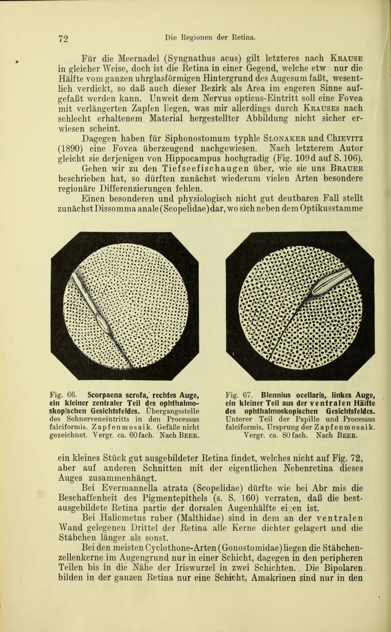 Für die Meernadel (Syngnathus acus) gilt letzteres nach Krause in gleicher Weise, doch ist die Retina in einer Gegend, welche etw nur die Hälfte vom ganzen uhrglasförmigen Hintergrund des Augesum faßt, wesent- lich verdickt, so daß auch dieser Bezirk als Area im engeren Sinne auf- gefaßt werden kann. Unweit dem Nervus opticus-Eintritt soll eine Fovea mit verlängerten Zapfen liegen, was mir allerdings durch Krauses nach schlecht erhaltenem Material hergestellter Abbildung nicht sicher er- wiesen scheint. Dagegen haben für Siphonostomum typhle Slonaker und ChiEviTZ (18.90) eine Fovea überzeugend nachgewiesen. Nach letzterem Autor gleicht sie derjenigen von Hippocampus hochgradig (Fig. 109 d auf S. 106). Gehen wir zu den Tiefseefischaugen über, wie sie uns Brauer beschrieben hat, so dürften zunächst wiederum vielen Arten besondere regionäre Differenzierungen fehlen. Einen besonderen und physiologisch nicht gut deutbaren Fall stellt zunächst Dissomma anale (Scopelidae) dar, wo sich neben dem Optikusstamme Fig. 66. Scorpaena scrofa,' rechtes Auge, ein kleiner zentraler Teil des ophthalmo- skopischen Gesichtsfeldes. Übergangsstelle des Sehnerveneintritts in den Processus falciformis. Zapfenmosaik. Gefäße nicht gezeichnet. Vergr. ca. 60fach. Nach Beer. Fig. 67. Blennius ocellaris, linkes Auge, ein kleiner Teil aus der ventralen Hälfte des ophthalmoskopischen Gesichtsfeldes. Unterer Teil der Papille und Processus falciformis. Ursprung der Zapfenmosaik. Vergr. ca. 80 fach. Nach Beer. ein kleines Stück gut ausgebildeter Ketina findet, welches nicht auf Fig. 72, aber auf anderen Schnitten mit der eigentlichen Nebenretina dieses Auges zusammenhängt. Bei Evermannella atrata (Scopelidae) dürfte wie bei Abr mis die Beschaffenheit des Pigmentepithels (s. S. 160) verraten, daß die best- ausgebildete Eetina partie der dorsalen Augenhälfte ei^^en ist. Bei Halicmetus ruber (Malthidae) sind in dem an der ventralen Wand gelegenen Drittel der Eetina alle Kerne dichter gelagert und die Stäbchen länger als sonst. Bei den meisten Cyclothone-Arten(Gonostomidae) liegen die Stäbchen- zellenkerne im Augengrund nur in einer Schicht, dagegen in den peripheren Teilen bis in die Nähe der Iriswurzel in zwei Schichten. . Die Bipolaren, bilden in der ganzen Eetina nur eine Schicht, Amakrinen sind nur in den