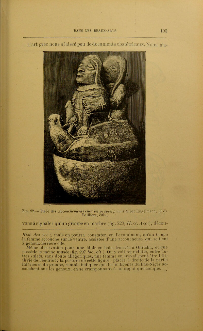 L’art grec nous a laissé pou de documents obstétricaux, Nous n’a- Fig. 92,— Tirée des Accouchements chez les peuples primitifs par Engelmann. (J.-13. Baillière, édit.) vous à signaler qu’un groupe en marbre (tig. 222, His/;. /Lee.), décou- Hist. des Acc.), mais on pourra constater, en l’examinant, qu’au Congo la femme accouche sur le ventre, assistée d’une accoucheuse qui se tient à genouxdcrrière elle. Même observation pour une idole en bois, trouvée à Onitcha, et que possède le même musée (fig. 297 loc. cit.). On y voit reproduite, entre au- tres sujets, sans doute allégoriques, une femme en travail,peut-être l’Ili- thyiede l’endroit; la posture de cette figure, placée à droite de la partie inférieure du groupe, semble indiquer que les indigènes du Bas-Niger ac- couchent sur les genoux, en se cramponnant à un appui quelconque. .