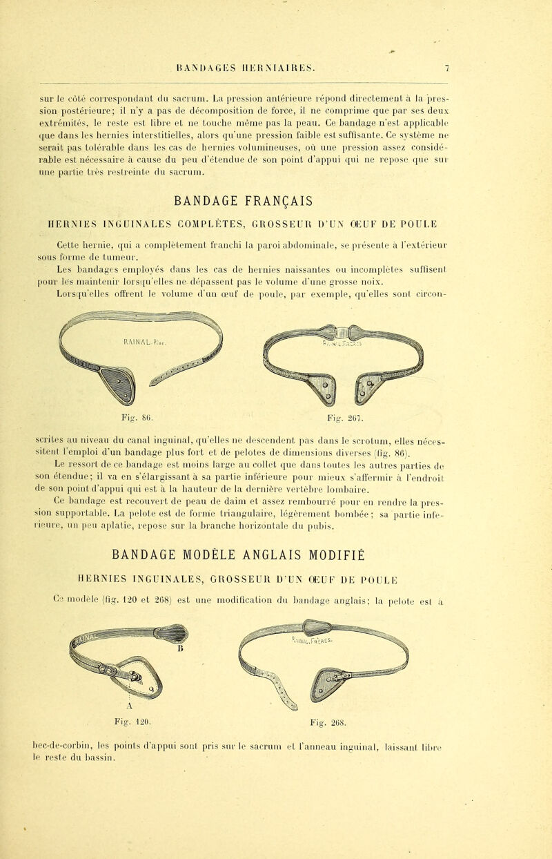 sur le côté correspondant du sacrum. La pression antérieure répond directement à Ja pres- sion postérieure; il n'y a pas de décomposition de force, il ne comprime que par ses deux extrémités, le reste est libre et ne touche même pas la peau. Ce bandage n'est applicable que dans les hernies interstitielles, alors qu'une pression faible est suffisante. Ce système ne serait pas tolérable dans les cas de hernies volumineuses, où une pression assez considé- rable est nécessaire cà cause du peu d'étendue de son point d'appui qui ne repose que sui une partie très restreinte du sacrum. BANDAGE FRANÇAIS HERMES INGUINALES COMPLETES, GROSSEUR D U.\ œUF DE POULE Cette hernie, qui a conq^lètement franchi la paroi abdominale, se présente ii l'extérieur sous forme de tumeur. Les bandages employés dans les cas de hernies naissantes ou incomplètes suffisent pour les maintenir lorsqu'elles ne dépassent pas le volume d'une grosse noix. Lorsiju'elles offrent le volume d'un œuf de poule, par exemple, qu'elles soni circon- Fig. 8G. Fig. 2U7. scrites au niveau du canal inguinal, qu'elles ne descendent pas dans le scrotum, elles néces- sitent l'emploi d'un bandage plus fort et de pelotes de dimensions diverses (fig. 86). Le ressort de ce bandage est moins large au collet que dans toutes les autres parties de son étendue; il va en s'élargissant à sa partie inférieure pour mieux s'affermir à l'endroit de son point d'appui qui est à la hauteur de la dernière vertèbre lombaire. Ce bandage est recouvert de peau de daim et assez rembourré pour en rendre la pres- sion supportable. La pelote est de fornie triangulaire, légèrement bombée ; sa partie infé- rieure, un peu aplatie, repose sur la branche horizontale du pubis. BANDAGE MODÈLE ANGLAIS MODIFIÉ HERNIES INGUINALES, GROSSEUR D'UN œUF DE POULE Ce modèle (tig. 120 et 268) est une modification du bandage anglais; la pelote esl à Fig. 120. Fig. 208. bec-de-corbin, les points d'appui son! pris sur le sacrum et fanneau inguinal, laissant lilire le reste du bassin.