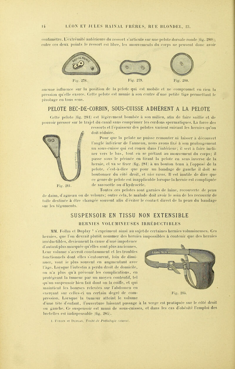 (•eiitimètre. L'extrémité antérieure du ressort s'articule sur une pelote dorsale ronde (fig. 280) ; entre ces deux points le ressori, esl lilire, les mouvements du corps ne peuvent donc avoir Fi-. 278. Fis-. 279. Fig. 280. aucune influence sur la position de la pelote qui est mobile et ne compromet en rien la pression qu'elle exerce. Cette pelote est munie à son centre d'une petite tige permettant le pivotage en tous sens. PELOTE BEC-DE-CORBIN, SOUS-CUISSE ADHÉRENT A LA PELOTE <;ette pelote (fig. 281) est légèrement bombée à son milieu, afin de faire saillie et de pouvoir presser sur le trajet du canal sans comprimer les cordons spermatiques. La force des ressorts et l'épaisseur des pelotes varient suivant les hernies qu'on doit réduire. Pour que la pelote ne puisse remonter ni laisser h. découvert l'angle inférieur de l'anneau, nous avons fixé à son prolongement un sous-cuisse qui est cousu dans l'intérieur; il sert à faire incli- ner vers le bas, tout en se prêtant au mouvement du corps; il passe sous le périnée en tirant la pelote en sens inverse de la hernie, et va se tixer (fig. 281) à un bouton tenu à l'opposé de la pelote, c'est-à-dire que pour un bandage de gauche il doit se boutonner du côté droit, et vice versa. Il est inutile de dire que ce genre de pelote est inapplicable lorsque la hernie est compliquée Pig. 281. sarcocèle ou d'hydrocèle. Toutes ces pelotes sont garnies de laine, recouverte de peau de daim, d'agneau ou de velours; outre cela, le malade doit avoir le soin de les recouvrir de toile destinée à être changée souvent afin d'éviter le contact direct de la peau du bandage sur les téguments. SUSPENSOIR EN TISSU NON EXTENSIBLE HERNIES VOLUMINEUSES IRRÉDUCTIBLES M.M. Follin et Duplay ' s'expriment ainsi au sujetde certaines hernies volumineuses. Ces hernies, que l'on devrait plutôt nommer des hernies impossibles à contenir que des hernies ii'réductibles, deviennent la cause d'une impotence d'iiulaiit plus marquée qu'elles sont plus anciennes. Leur volume s'accroît constamment et les troubles fonctionnels dont elles s'entourent, loin de dimi- nuer, vont le plus souvent en augmentant avec l'âge. Lorsque l'intestin a perdu droit de domicile, on n'a plus qu'à prévenir les complications, en pi olégeant la tumeur par un moyen contentif, tel (ju'un suspensoir bien fait dont on la coiffe, et qui mainlient les bourses relevées sur l'abdomen eu exerçant sur celles-ci un certain degré de com- pression. Lorsque la tumeur atteint le volume d'une tèle d'enfant, l'ouverture laissant passage à la verge est pratiquée sur le côté droit ou gauche. Ce suspensoir est muni de sous-cuisses, et dans les cas d'obésité l'emploi des bretelles esl indispensable (fig. 284). 1. l'oLi.iN et Dui'LAV, Tl'ait(} Je l'iitliolof/ic externe.