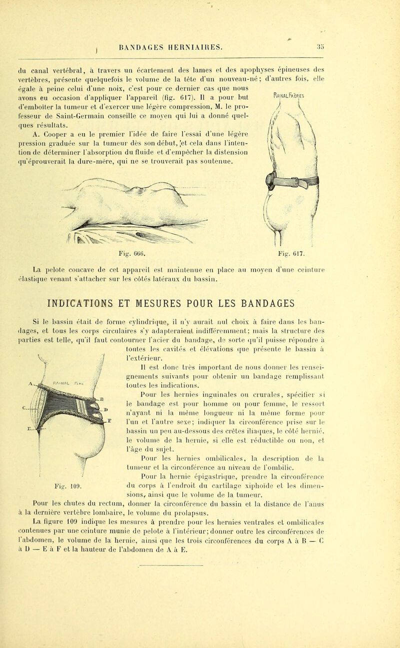 RainaL-Freres du canal vertébral, à travers un écarlement des lames et des apophyses épineuses des vertèbres, présente quelquefois le volume de la tête d'un nouveau-né ; d'autres fois, elle égale à peine celui d'une noix, c'est pour ce dernier cas (jue nous avons eu occasion d'appliquer l'appareil (fig. 617). II a pour but d'emboîter la tumeur et d'exercer une légère compiession, M. le pro- fesseur de Saint-Germain conseille ce moyen qui lui a donné quel- ques résultats. A. Cooper a eu le premier l'idée de faire l'essai d'une légère pression graduée sur la tumeur dès son début, |et cela dans l'inten- tion de déterminer l'absorption du fluide et d'empêcher la distension qu'éprouverait la dure-mère, qui ne se trouverait pas soutenue. Fig. 666. La pelote concave de cet appareil est maintenue en place au moyen d'une ceinture élastique venant s'attacher sur les côtés latéraux du bassin. INDICATIONS ET MESURES POUR LES BANDAGES Si le bassin était de forme rylindiique, il n'y aurait nul choix à faire dans les ban- dages, et tous les corps circulaires s'y adapteraient indifféremment; mais la structure des [larties est telle, qu'il faut contourner l'acier du bandage, de sorte qu'il puisse répondre à toutes les cavités et élévations que présente le bassin à l'extérieur. H est donr très important de nous donner les rensei- gnements suivants pour olitenir un bandage remplissant toutes les indications. Pour les hernies inguinales ou crurales, spécifier si le bandage est pour homme ou pour femme, le ressoii n'ayant ni la même longueur ni la même forme pour l'un et l'autre sexe; indiquer la circonférence prise sur le bassin un peu au-dessous des crêtes iliaques, le côté hernie, le volume de la hernie, si elle est réducti!>le ou non, et l'âge du sujet. Pour les hernies ombilicales, la description de la tumeur et la circonférence au niveau de l'ombilic. Pour la hernie épigastrique, prendre la circonférence du corps à l'endroit du cartilage xiphoïde et les dimen- sions, ainsi que le volume de la tumeur. Pour les chutes du rectum, donner la circonférence du bassin et la dislance de l'auas à la dernière vertèbre lombaire, le volume du prolapsus. La figure 109 indique les mesures à prendre pour les hernies ventrales et ombilicales contenues par une ceinture munie de pelote à l'intérieur; donner outre les circonférences de l'abdomen, le volume de la hernie, ainsi que les trois circonférences du corps A à B — C il U — E à F et la hauteur de l'abdomen de A à E. Fie. 109.