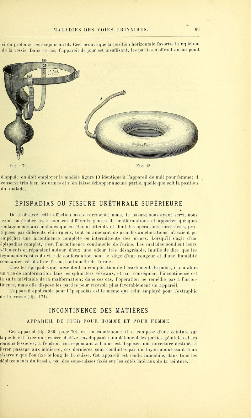 si on prolonge leur séjour au lit. Ceci prouve que la position horizontale favorise la replétioa de la vessie. Dans ce cas, l'appareil de jour est insuffisant, les parties n'offrant aucun point Fig. 171. Fig. 13. d'appui; on doit employer le modèle figure 13 identique à l'apfiareil de nuit pour femme; il conserve très bien les urines et n'en laisse échapper aucune partie, quelle que soit la position du malade. ÉPISPADIAS OU FISSURE URÉTHRALE SUPÉRIEURE • On a observé cette affection assez rarement; mais, le hasai'd nous ayant servi, nous avons pu étudier avec soin ces différents genres de malformations et apporter quelques soulagements aux malades qui en étaient atteints et dont les opérations successives, pra- tiquées par différents chirurgiens, tout en amenant de grandes améliorations, n'avaient pu empêcher une incontinence complète ou intermittente des urines. Lorsqu'il s'agit d'un épispadias complet, c'est l'incontinence continuelle de l'urine. Les malades souillent leurs vêtements et répandent autour d'eux une odeur très désagréable. Inutile de dire que les téguments voisins du vice de conformation sont le siège d'une rougeur et d'une humidité constantes, résultat de l'issue continuelle de l'urine. Chez les épispades qui présentent la complication de l'écartement du pubis, il y a alors un vice de conformation dans les sphincters vésicaux, et par conséquent l'incontinence est la suite inévitable de la malformation; dans ces cas, l'opération ne remédie pas à l'incon- tinence, mais elle dispose les parties pour recevoir plus favorablement un appareil. L'appareil applicable pour l'épispadias est le môme que celui employé pour l'extrophie de la vessie (fig. 171). INCONTINENCE DES MATIÈRES APPAREIL DE JOUR POL'R HOMME ET POUR FEMME Cet appareil (fig. 3o6, page 70), est en caoutchouc; il se compose d'une ceinture sur laquelle est fixée une espèce d'alèze enveloppant complètement les [larties génitales et les régions fessières; à l'endroit correspondant à l'anus est disposée une ouverture destinée à livrer passage aux matières; ces dernières sont conduites par un tuyau aboutissant à un réservoir que l'on fixe le long de la cuisse. Cet appareil est rendu immobile, dans tous les déplacements du bassin, par des sous-cuisses fixés sur les côtés latéraux de la ceinture.