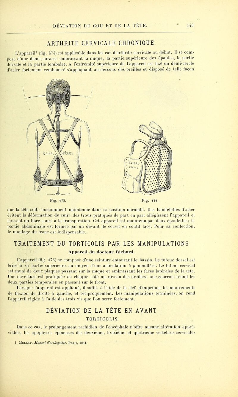 ARTHRITE CERVICALE CHRONIQUE L'appareil' (fig. 474) est applicable dans les cas d'arlhrite cervicale au débal. 11 se com- pose d'une demi-cuirasse embrassant la nuque, la partie supérieure des épaules, la partie dorsale et la partie lombaire. A l'extrémité supérieure de l'appareil est fixé un demi-cercle d'acier fortement rembourré s'appliquant au-dessous des oreilles et disposé de telle façon Fig. 47S. Fig. 474. que la tête soit constamment maintenue dans sa position normale. Des bandelettes d'acier évitent la déformation du cuir; des trous pratiqués de part en part allégissent l'appareil et laissent un lilire cours à la transpiration. Cet appareil est maintenu par deux épauletles; la partie al)dominale est formée par un devant de corset en coutil lacé. Pour sa confection, le moulage du tronc est indispensable. TRAITEMENT DU TORTICOLIS PAR LES MANIPULATIONS Appai'eil du docteur Richard. L'appareil (fig. 47S) se compose d'une ceinture entourant le bassin. Le tuteur dorsal est brisé à sa partie supérieure au moyen d'une articulation à genouillère. Le tuteur cervical est muni de deux plaques passant sur la nuque et embrassant les faces latérales de la tète. Une ouverture est pratiquée de chaque côté au niveau des oreilles; une courroie réunit les deux parties temporales en passant sur le front. Lorsque l'appareil est appliqué, il suffit, à l'aide de la clef, d'imprimer les mouvements de flexion de droite à gauche, et réciproquement. Les manipulations terminées, on rend l'appareil rigide à l'aide des trois vis que l'on serre fortement. DÉVIATION DE LA TÊTE EN AVANT TORTICOLIS Dans ce cas, le prolongement rachidien de l'encéphale n'offre aucune altération appré- ciable; les apophyses épineuses des deuxième, troisième et rpiatrième vertèbres cervicales 1. MuLiJiT, Maivicl d'ortIiopédU'. Paris, 1844.