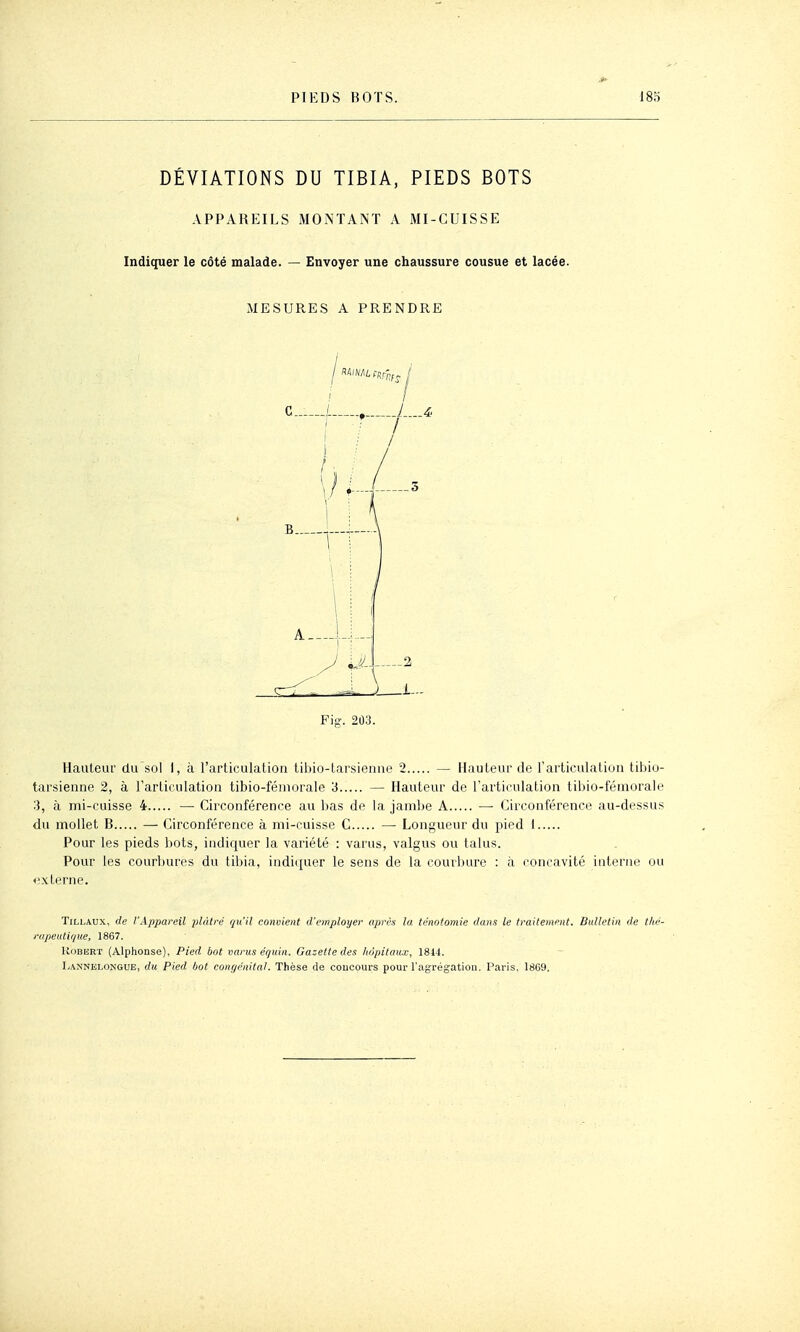 DÉVIATIONS DU TIBIA, PIEDS BOTS APPAREILS MONTANT A MI-CUISSE Indiquer le côté malade. — Envoyer une chaussure cousue et lacée. MESURES A PRENDRE / 1 i / / / 3 \\\ ) 2 Fig. 2Û3. A' Hauteur du sol 1, à l'articulation tibio-tarsienne 2 — Hauteur de l'articulation tibio- tarsienne 2, à l'arliculation tibio-féniorale 3 — Hauteur de l'articulation tibio-fémorale 3, à mi-cuisse 4 — Circonférence au bas de la jambe A — Circonférence au-dessus du mollet B — Circonférence à mi-cuisse C — Longueur du pied 1 Pour les pieds bots, indiquer la variété : varus, valgus ou talus. Pour les courbures du tibia, indi([uer le sens de la couilnire : à concavité interne ou «xterne. TiLLAUx, de l'Appareil plâtré qu'il convient d'employer après la. ténotomie dans le traitement. Bulletin de tlie- i-upeuti(iue, 1867. UdBBRT (Alphonse), Pied bot varus équin. Gazette des hôpitaux, 1841. Lannelongue, du Pied bot congénital. Thèse de concours pour l'agrégation. Paris. 18G9.