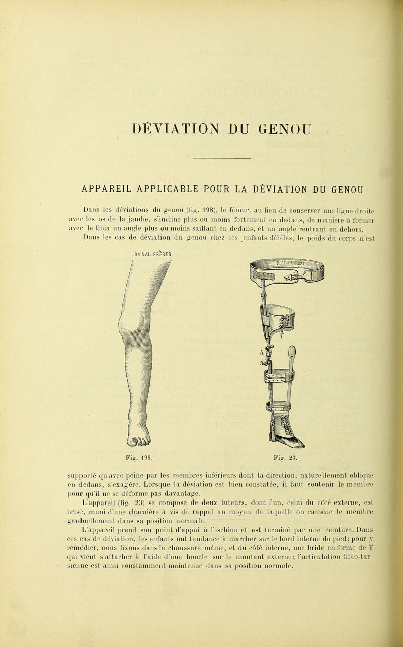 DÉVIATION DU GENOU APPAREIL APPLICABLE POUR LA DÉVIATION DU GENOU Dans les déviations du genou (tig. 198), le fémur, au lieu de conserver une ligne droite avec les os de la jambe, s'incline plus ou moins fortement en dedans, de manière à former avec le tibia un angle plus ou moins saillant en dedans, et un angle rentrant en dehors. Dans les cas de déviation du genou chez les enfants débiles, le poids du corps nest RAINAL FRERES Fig. 198. Pig. 23. supporté qu'avec peine par les membres inférieurs dont la direction, naturellement oldique en dedans, s'exagère. Lorsque la déviation est bien constatée, il faut soutenir le membre pour qu'il ne se déforme pas davantage. L'appareil (fig. 23) se compose de deux, tuteurs, dont l'un, celui du côté externe, est brisé, muni d'une charnière à vis de rappel au moyen de laquelle on ramène le membre graduellement dans sa position normale. L'appareil prend son point d'appui à l'ischion et est terminé par une ceinture. Dans ces cas de déviation, les enfants ont tendance à marcher sur le bord interne du pied; pour y remédier, nous fixons dans la chaussure même, et du côté interne, une bride enferme de T qui vient s'attacher à l'aide d'une boucle sur le montant externe; l'articulation tibio-tar- sienne est ainsi constamment maintenue dans sa position normale.