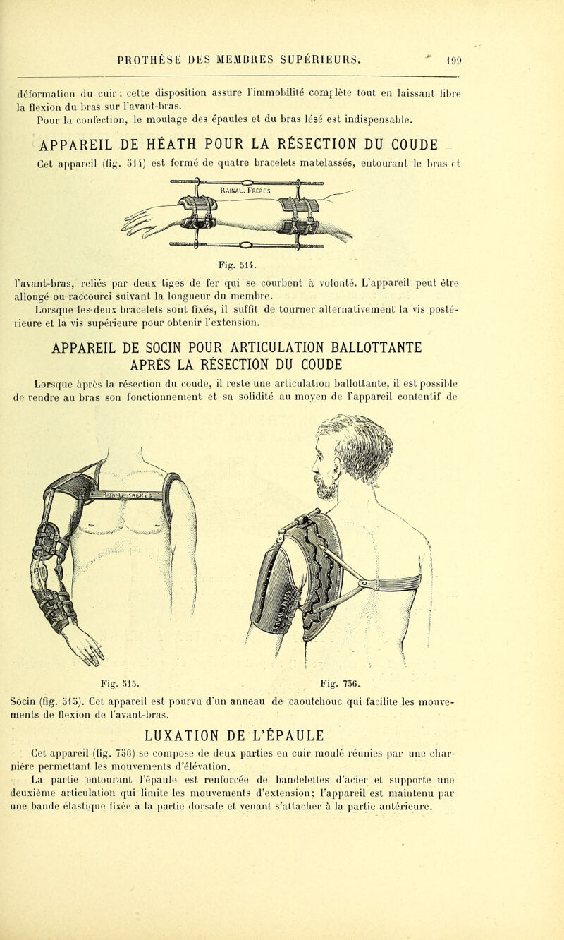 (léfonnaLioii du cuir : cette disposition assure l'immobililé com[ lète tout en laissant liijre la flexion du bras sur l'avant-bras. Pour la confection, le moulage des épaules et du bras lésé est indispensable. APPAREIL DE HÉATH POUR LA RÉSECTION DU COUDE Cet appareil (fig. oli) est formé de quatre bracelets matelassés, entourant le bras et Fig. S14. l'avant-bras, reliés par deux tiges de fer qui se courbent à volonté. L'appareil peut être allongé ou raccourci suivant la longueur du membre. Lorsque les-deux bracelets sont fixés, il suffit de tourner alternativement la vis posté- l ieure et la vis supérieure pour obtenir l'extension. APPAREIL DE SOCIN POUR ARTICULATION BALLOTTANTE APRÈS LA RÉSECTION DU COUDE Lorsque après la résection du coude, il reste une articulation ballottante, il estpossiide de rendre au bras son fonctionnement et sa solidité au moyen de l'appareil contentif de Fig. 313. . Fig. 736. Socin (fig. 51 o). Cet appareil est pourvu d'un anneau de caoutchouc qui facilite les mouve- ments de flexion de l'avant-bras. LUXATION DE L'ÉPAULE Cet appareil (fig. 750) se compose de deux parties en cuir moulé réunies par une char- nière permettant les mouvements d'élévation. La partie entourant l'épaule est renforcée de bandelettes d'acier et supporte nne deuxième articulation qui limite les mouvements d'extension; l'appareil est maintenu par une bande élastique fixée à la partie dorsale et venant s'attacher à la partie antérieure.