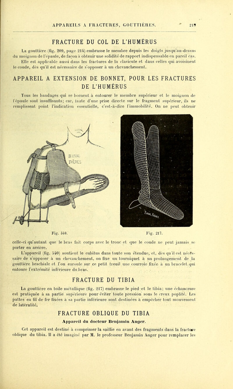 FRACTURE DU COL DE L'HUMÉRUS La gouttière (fig. 209, page 214) embrasse le membre depuis les doigts jusqu'au-dessus (lu moignon de l'épaule, de façon à obtenir une solidité de rapport indispensable en pareil cas. Elle est applicable aussi dans les fractures de la clavicule et dans celles qui avoisinent le coude, dès qu'il est nécessaire de s'opposer à un chevauchement. APPAREIL A EXTENSION DE BONNET, POUR LES FRACTURES DE L'HUMÉRUS Tous les bandages qui se bornent à entourer le membre supérieur et le moignon de l'épaule sont insuffisants; car, laute d'une prise directe sur le fragment supérieur, ils ne remplissent point l'indication essentielle, c'est-à-dire l'immobilité. On ne peut obtenir Fig. 340. Fig. 217. celle-ci qu'autant que le bras fait corps avec le tronc et que le coude ne peut jamais se porter en arrière. L'appareil (fig. 540) soutient le cubitus dans toute son étendue, et, dès qu'il est nécCa- saire de s'opposer à un chevaurhemeirt, on fixe un tourniquet à un prolongement de la gouttière brachiale et l'on enroule sur ce petit tieuil une courroie fixée à un bracelet,,qui entoure l'extrémité inférieure du bras. FRACTURE DU TIBIA La gouttière en toile mélallique (fig. 217) embrasse le pied et le tibia; une échancrurc est pratiquée à sa partie supérieure pour éviter toute pression sous le creux poplité. Les pattes en fil de fer fixées à sa partie inférieure sont destinées à empêcher tout mouvement de latéralité. FRACTURE OBLIQUE DU TIBIA Appareil du docteur Benjamin Anger, Cet appareil est destiné à comprimer la saillie en avant des fragments dans la fractun'e oblique du tibia. 11 a été imaginé par M. le professeur Benjamin Anger pour remplacer les