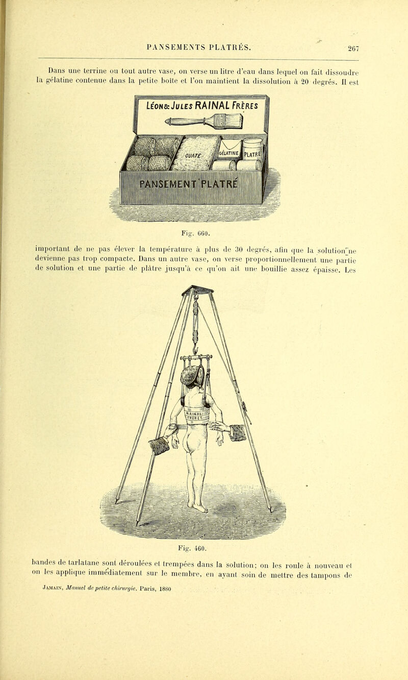 Dans une terrine ou tout autre vase, on verse un litre d'eau dans lequel on fait dissoudre la gélatine contenue dans la petite boîte et l'on maintient la dissolution à 20 degrés. Il est Fis. 660. important de ne pas élever la température à plus de 30 degrés, afin que la solution ne devienne pas trop compacte. Dans un autre vase, on verse proportionnellement une partie de solution et une partie de plâtre jusqu'à ce qu'on ait une bouillie assez épaisse. Les Fio-. 460. bandes de tarlatane sont déroulées et trempées dans la solution; on les roule à nouveau el on les applique immédiatement sur le membre, en ayant soin de mettre des tampons de •l/^MM!^, Manuel de petite chirurgie. Pa.vis, ISSO