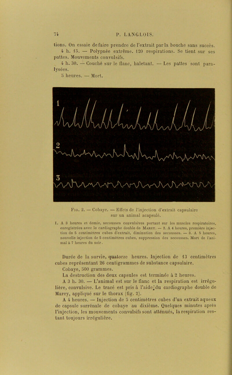 tions. On essaie défaire prendre de l’extrait parla bouche sans succès. 4 h. lb. — Polypnée extrême. 120 respirations. Se tient sur ses pattes. Mouvements convulsifs. 4 h. 30. — Couché sur le flanc, haletant. — Les pattes sont para- lysées. 5 heures. — Mort. Fig. 2. — Cobaye. — Effets de l’injection d’extrait capsulaire sur un animal acapsulé. I. A 3 houros ot demie, sccoussos convulsivos portant sur les muscles respiratoiros, enregistrées avec le cardiographe double do Marey. — 2. A 4 houros, promièro injec- tion do 5 centimètres cubes d’extrait, diminution dos secousses. — 3. A 5 houros, nouvelle injection do 5 contimùtros cubes, suppression dos secousses. Mort do l'ani- mal à 7 heures du soir. Durée de la survie, quatorze heures. Injection de 13 centimètres cubes représentant 26 centigrammes de substance capsulaire. Cobaye, 300 grammes. La destruction des deux capsules est terminée à 2 heures. A 3 h. 30. — L’animal est sur le flanc et la respiration est irrégu- lière, convulsive. Le tracé est prisa l’aide;du cardiographe double de Marey, appliqué sur le thorax (fig. 2). A 4 heures. — Injection de 5 centimètres cubes d’un extrait aqueux de capsule surrénale de cobaye au dixième. Quelques minutes après l’injection, les mouvements convulsifs sont atténués, la respiration res- tant toujours irrégulière.