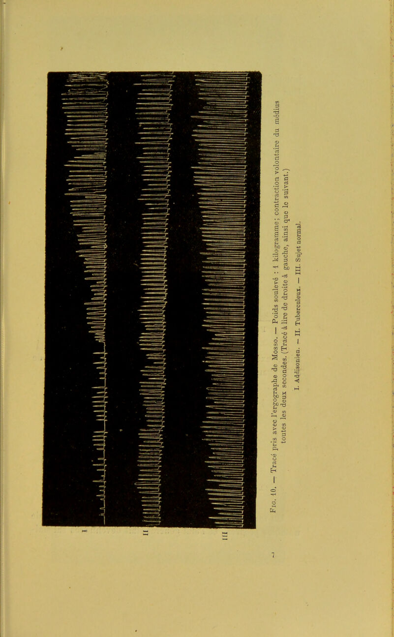 - / T3 '<D a d rd d o o ► d d d O d *.d rf p c ^ O 0 g « ^ S *OT S .2 c3 aî P4 g* § 3 1 _ d bD -d «<ü ? ® D 3 ° g ^ « -S -d ^ Dh £3 d H o <d en d o *0) o d Sh Eh O &H H i‘ 1. . — III. Sujet normal.