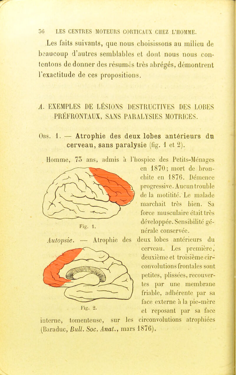 Les faits suivants, que nous choisissons au milieu de beaucoup d'autres semblables cl dont nous nous con- tentons de donner des résumés très abrégés, démontrent l'exactitude de ces propositions. A. EXEMPLES DE LÉSIONS DESTRUCTIVES DES LOBES PRÉERONTAUX, SANS PARALYSIES MOTRICES. Fier. 1 Obs. 1. — Atrophie des deux lobes antérieurs du cerveau, sans paralysie (fig. 1 et 2). Homme, 73 ans, admis a l'hospice des Petits-Ménages en 1870; mort de bron- chite en 1876. Démence progressive. Aucun trouble de la motilité. Le malade marchait très bien. Sa force musculaire était très développée. Sensibilité gé- nérale conservée. Atrophie des deux lobes antérieurs du cerveau. Les première, deuxième et troisième cir- convolutions frontales sont petites, plissées, recouver- tes par une membrane friable, adhérente par sa face externe h la pie-mère et reposant par sa face interne, tomenteuse, sur les circonvolutions atrophiées (Baraduc, Bull. Soc. Anat., mars 1876). Autopsie.