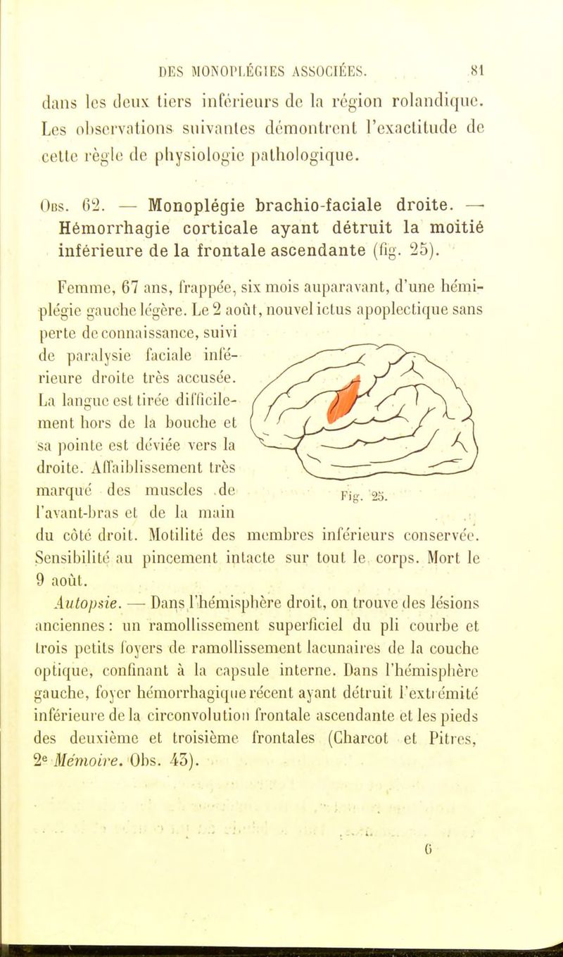 dans les deux tiers inférieurs de la région rolandique. Les observations suivantes démontrent l'exactitude de cette règle de physiologie pathologique. Otis. 62. — Monoplégie brachio-faciale droite. — Hémorrhagie corticale ayant détruit la moitié inférieure de la frontale ascendante (fig. 25). Femme, 67 ans, frappée, six mois auparavant, d'une hémi- plégie gauche légère. Le 2 août, nouvel ictus apoplectique sans perte de connaissance, suivi de paralysie faciale infé- rieure droite très accusée. La langue est tirée difficile- ment hors de la bouche et sa pointe est déviée vers la droite. Affaiblissement très marqué des muscles .de l'avant-bras et de la main du côté droit. Motilité des membres inférieurs conservée. Sensibilité au pincement intacte sur tout le corps. Mort le 9 août. Autopsie. — Dans l'hémisphère droit, on trouve des lésions anciennes : un ramollissement superficiel du pli courbe et trois petits foyers de ramollissement lacunaires de la couche optique, confinant à la capsule interne. Dans l'hémisphère gauche, foyer hémorrhagique récent ayant détruit l'extrémité inférieure delà circonvolution frontale ascendante et les pieds des deuxième et troisième frontales (Charcot et Pitres, 2e Mémoire. Obs. 45).