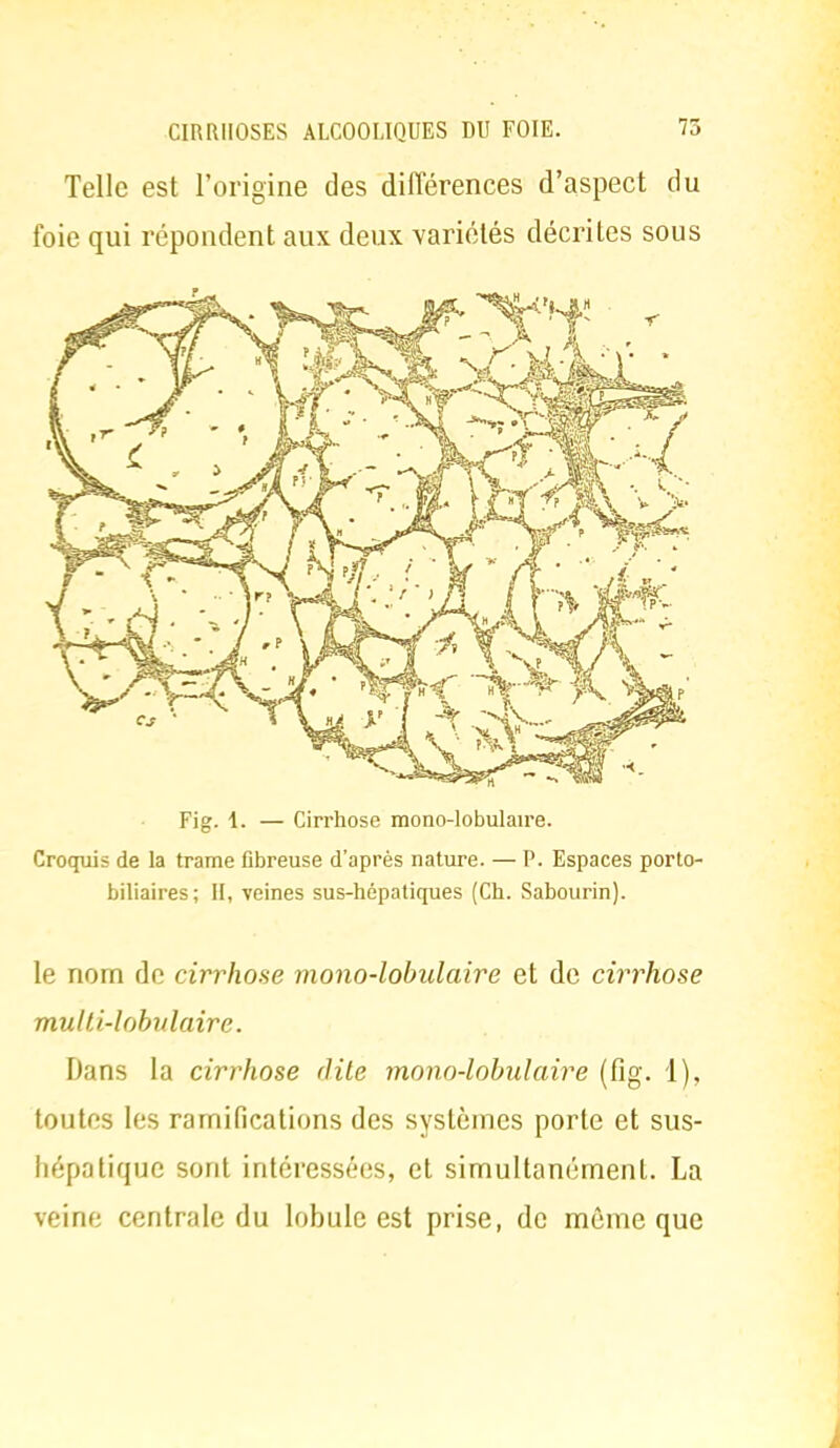 Telle est l'origine des différences d'aspect du foie qui répondent aux deux variétés décrites sous Fi g. 1. — Cirrhose mono-lobulaire. Croquis de la trame fibreuse d'après nature. — P. Espaces porto- biliaires; II, veines sus-hépatiques (Ch. Sabourin). le nom de cirrhose mono-lobulaire et de cirrhose multi-lobulaire. Dans la cirrhose dite mono-lobulaire (fig. 1), toutes les ramifications des systèmes porte et sus- hépatique sont intéressées, et simultanément. La veine centrale du lobule est prise, de même que